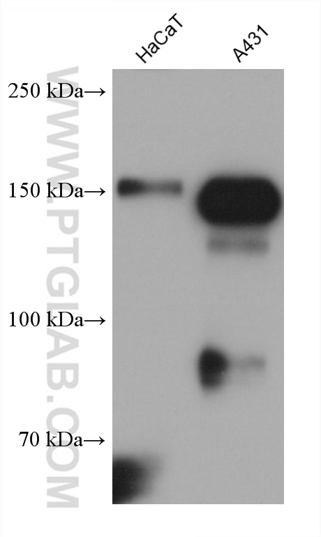 Western Blot (WB) analysis of various lysates using EGFR Monoclonal antibody (68643-1-Ig)