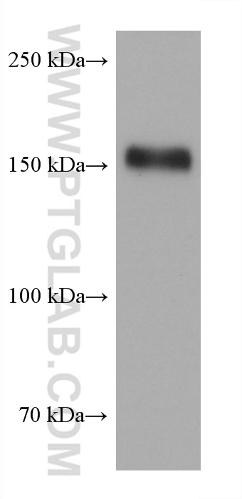 Western Blot (WB) analysis of SCaBER cells using EGFR Monoclonal antibody (68643-1-Ig)