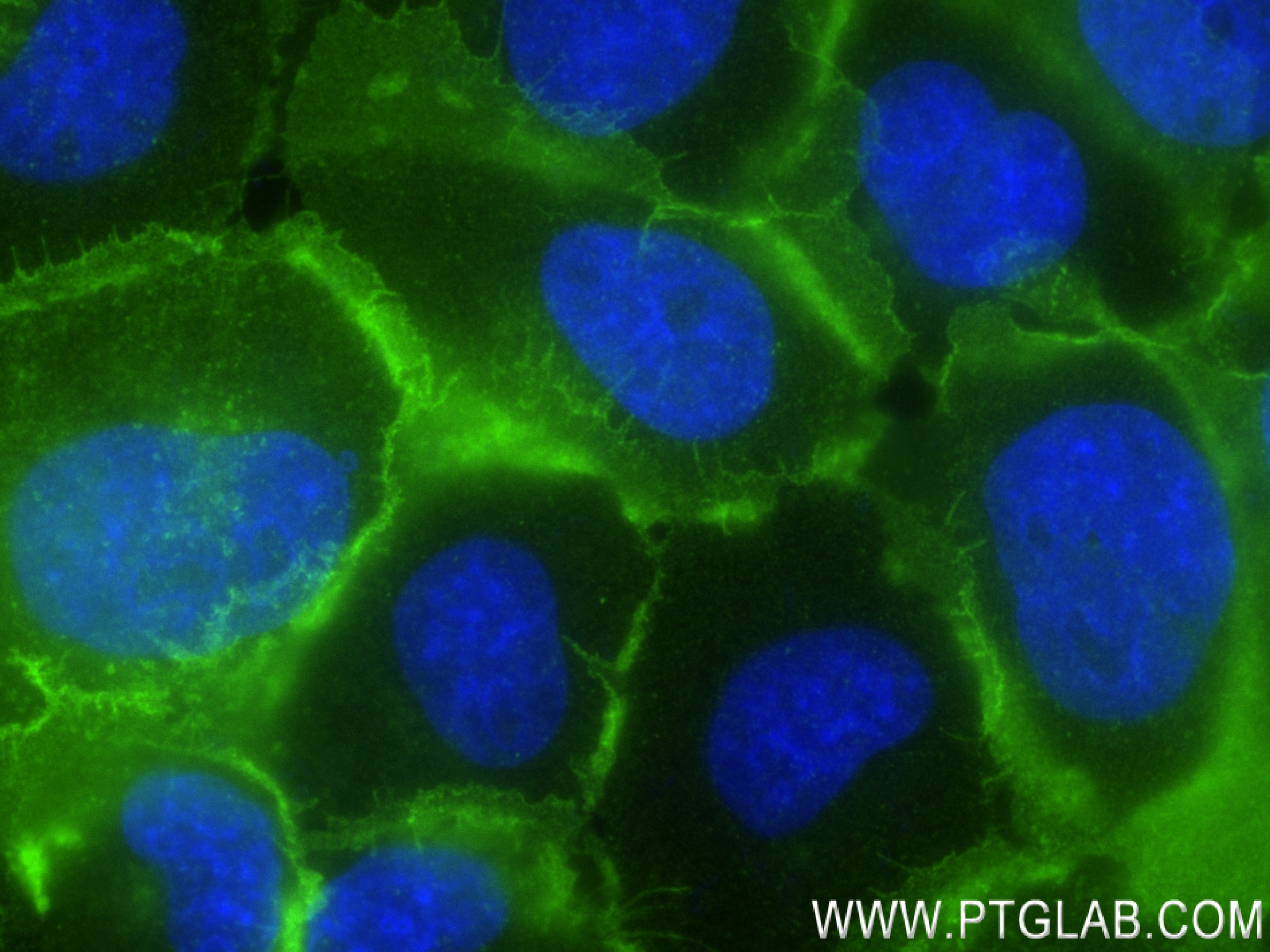 Immunofluorescence (IF) / fluorescent staining of A431 cells using EGFR Recombinant antibody (83806-1-RR)