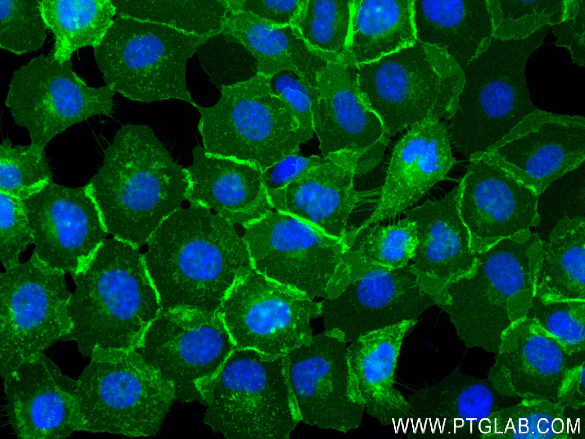 Immunofluorescence (IF) / fluorescent staining of A431 cells using EGFR Recombinant antibody (83806-1-RR)