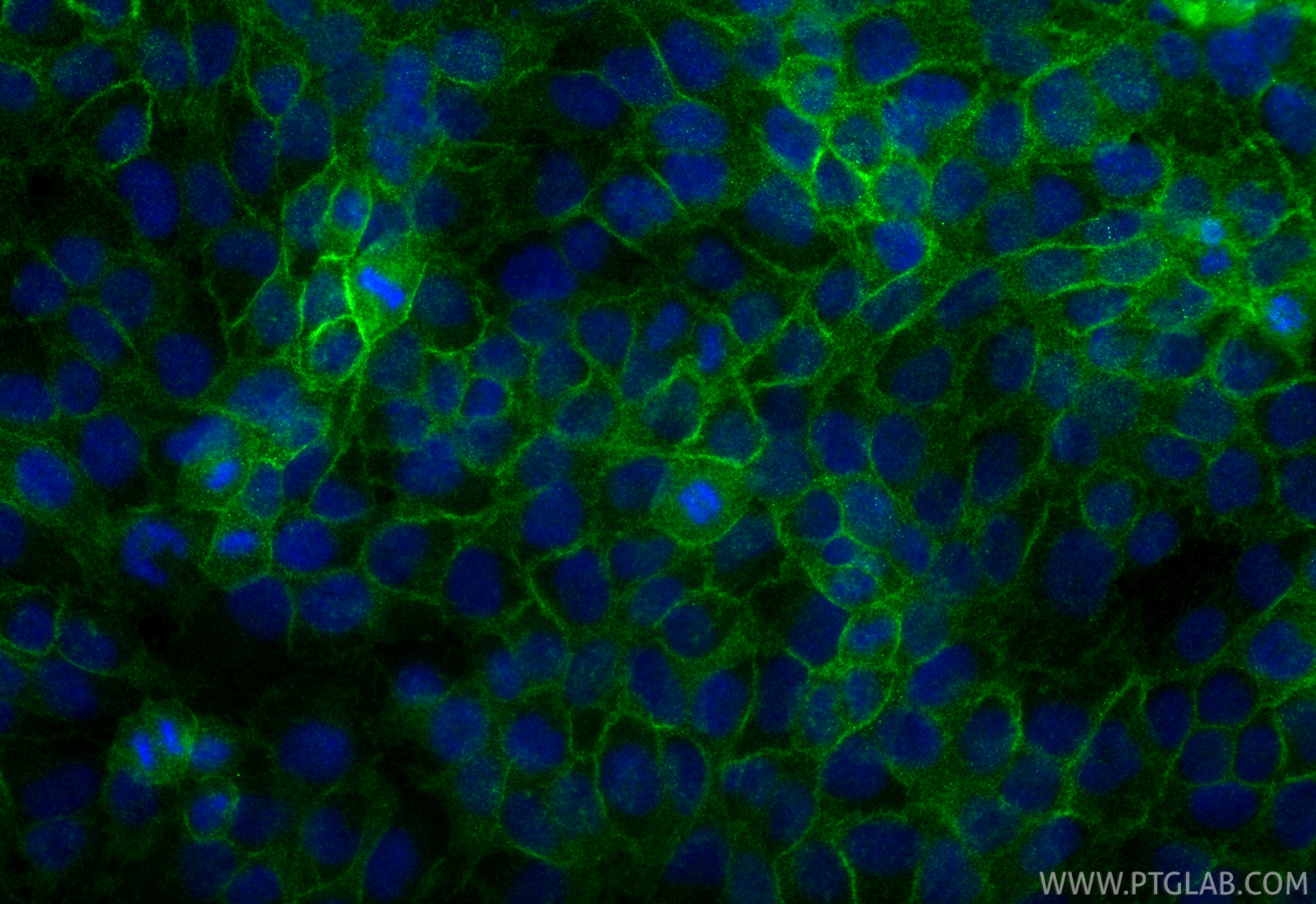 Immunofluorescence (IF) / fluorescent staining of HaCaT cells using EGFR Recombinant monoclonal antibody (83806-1-RR)
