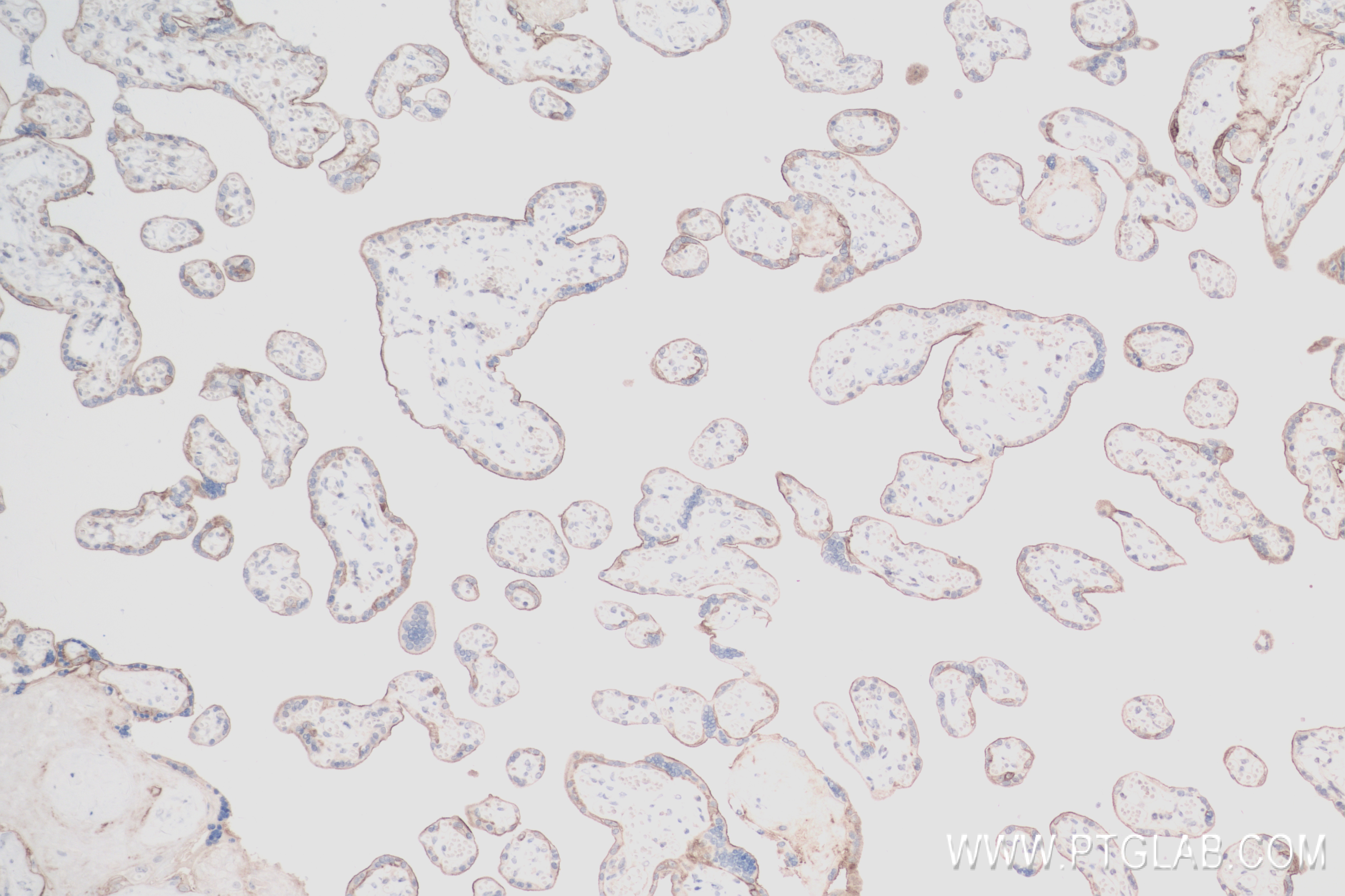 Immunohistochemistry (IHC) staining of human placenta tissue using EGFR Recombinant antibody (83806-1-RR)