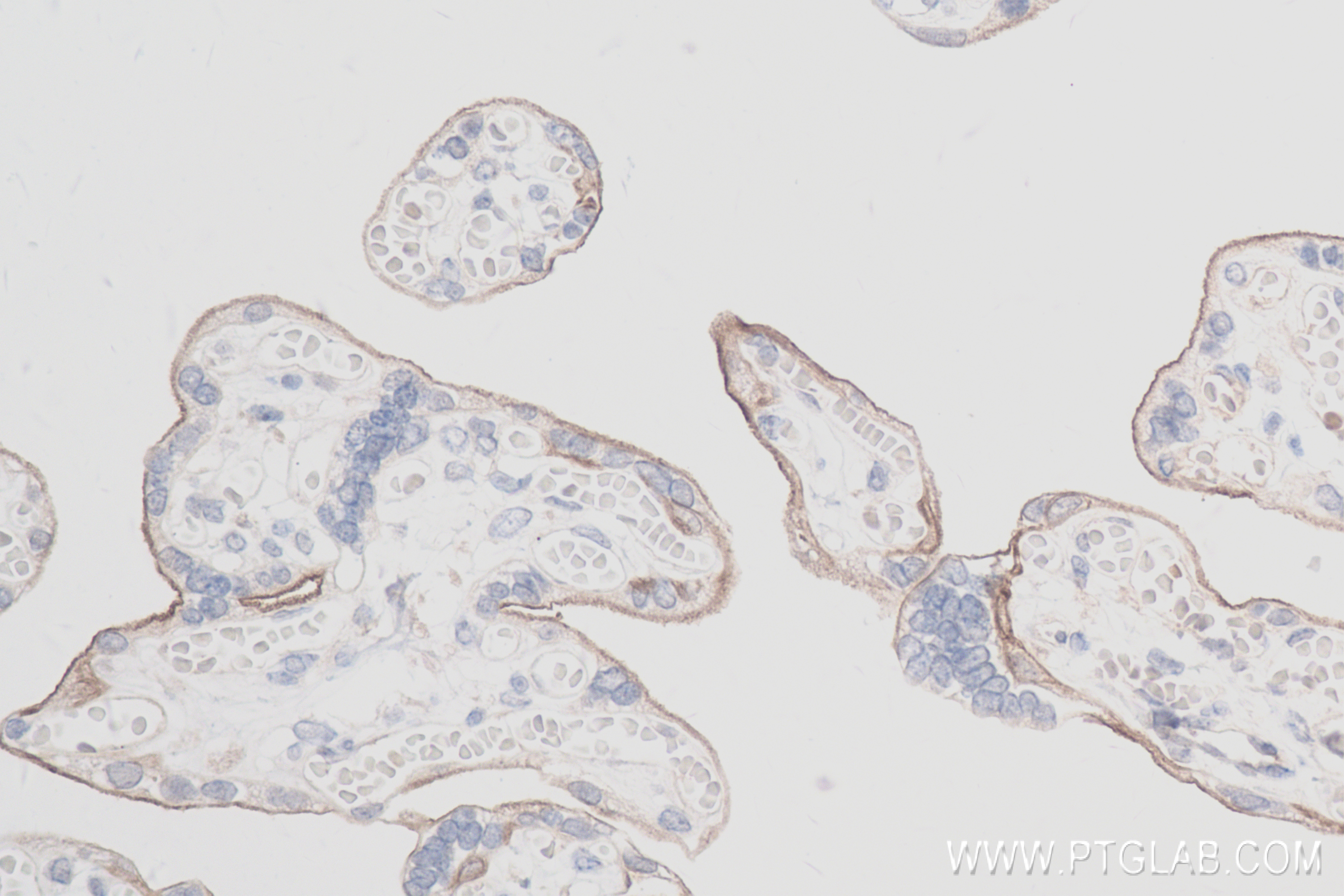 Immunohistochemistry (IHC) staining of human placenta tissue using EGFR Recombinant antibody (83806-1-RR)