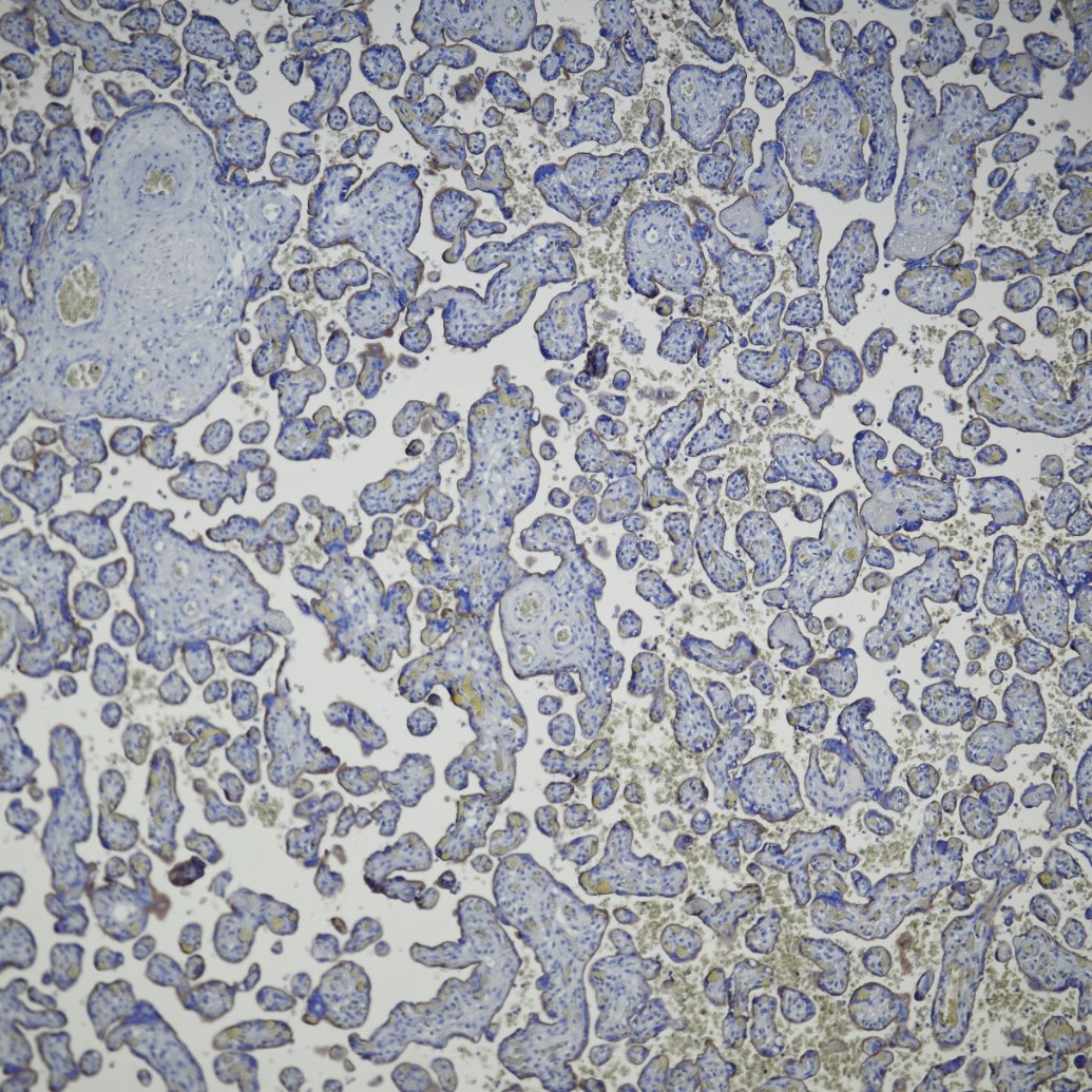 Immunohistochemistry (IHC) staining of human placenta tissue using EGFR Recombinant monoclonal antibody (83806-1-RR)