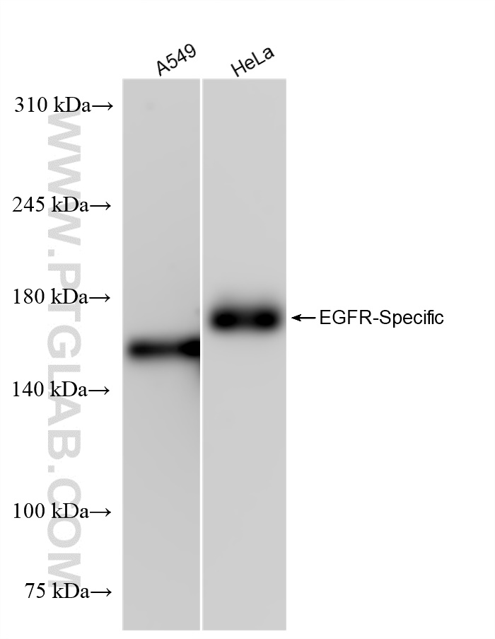 Western Blot (WB) analysis of various lysates using EGFR Recombinant antibody (83806-1-RR)