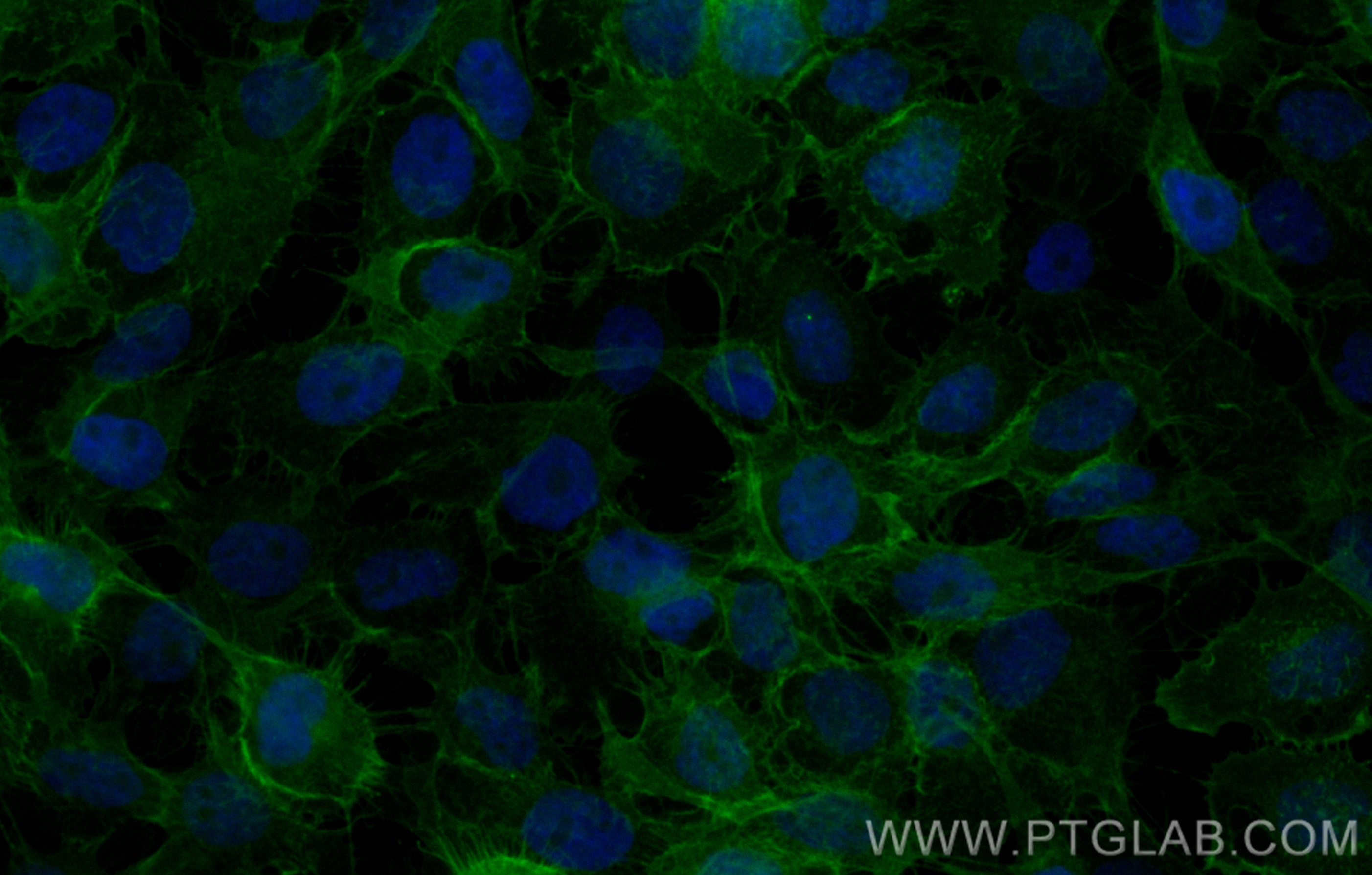 Immunofluorescence (IF) / fluorescent staining of A431 cells using CoraLite® Plus 488-conjugated EGFR Recombinant ant (CL488-83806)