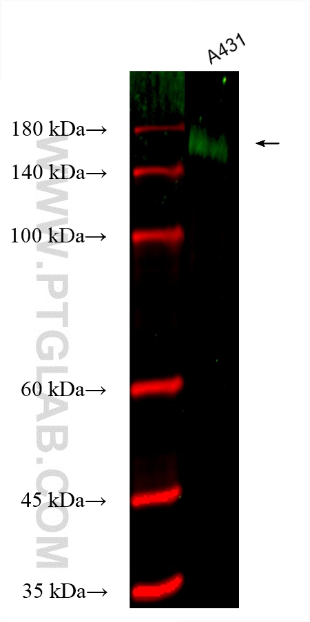 EGFR (C-terminal)