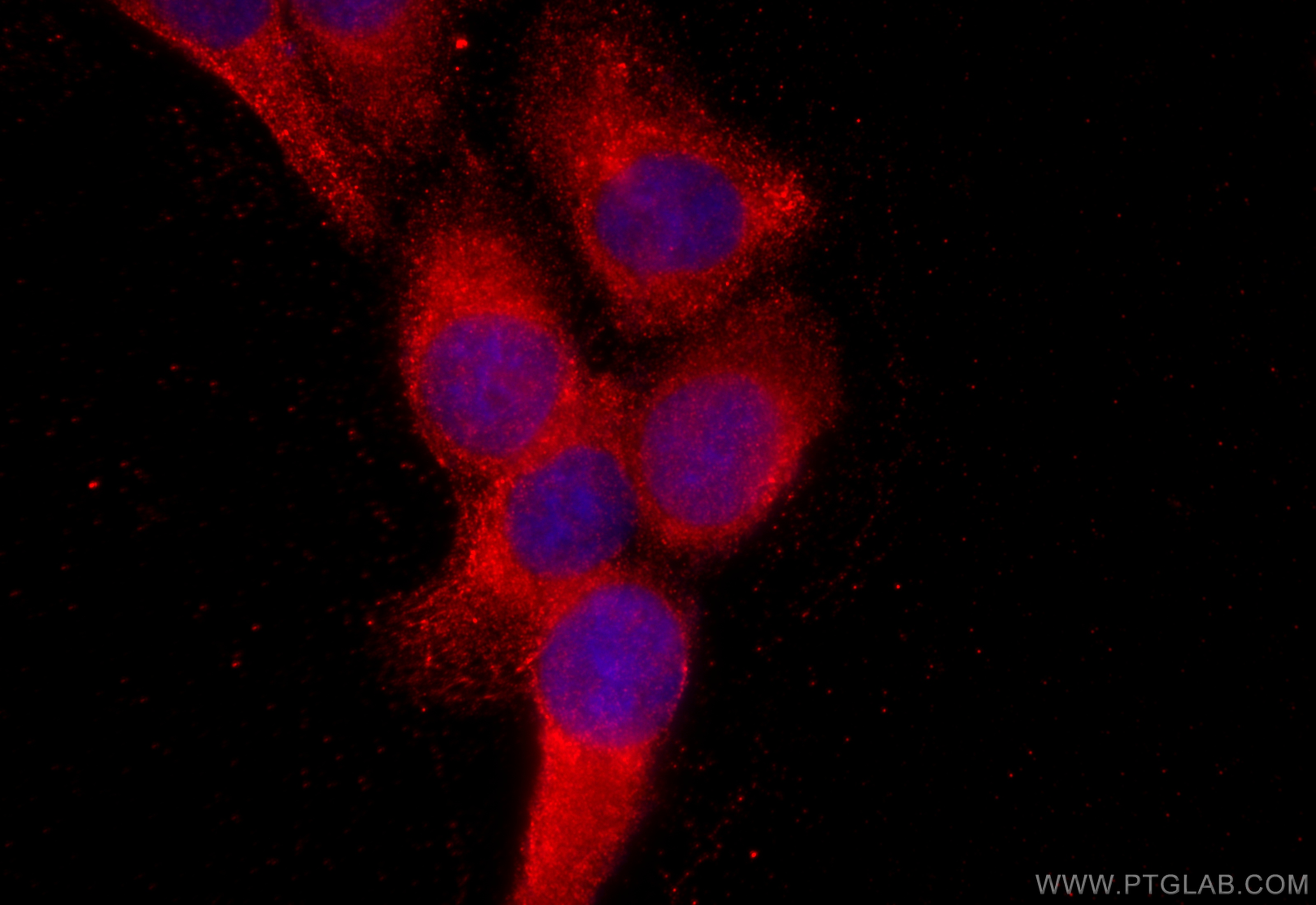 Immunofluorescence (IF) / fluorescent staining of A431 cells using PHD2/EGLN1 Polyclonal antibody (19886-1-AP)