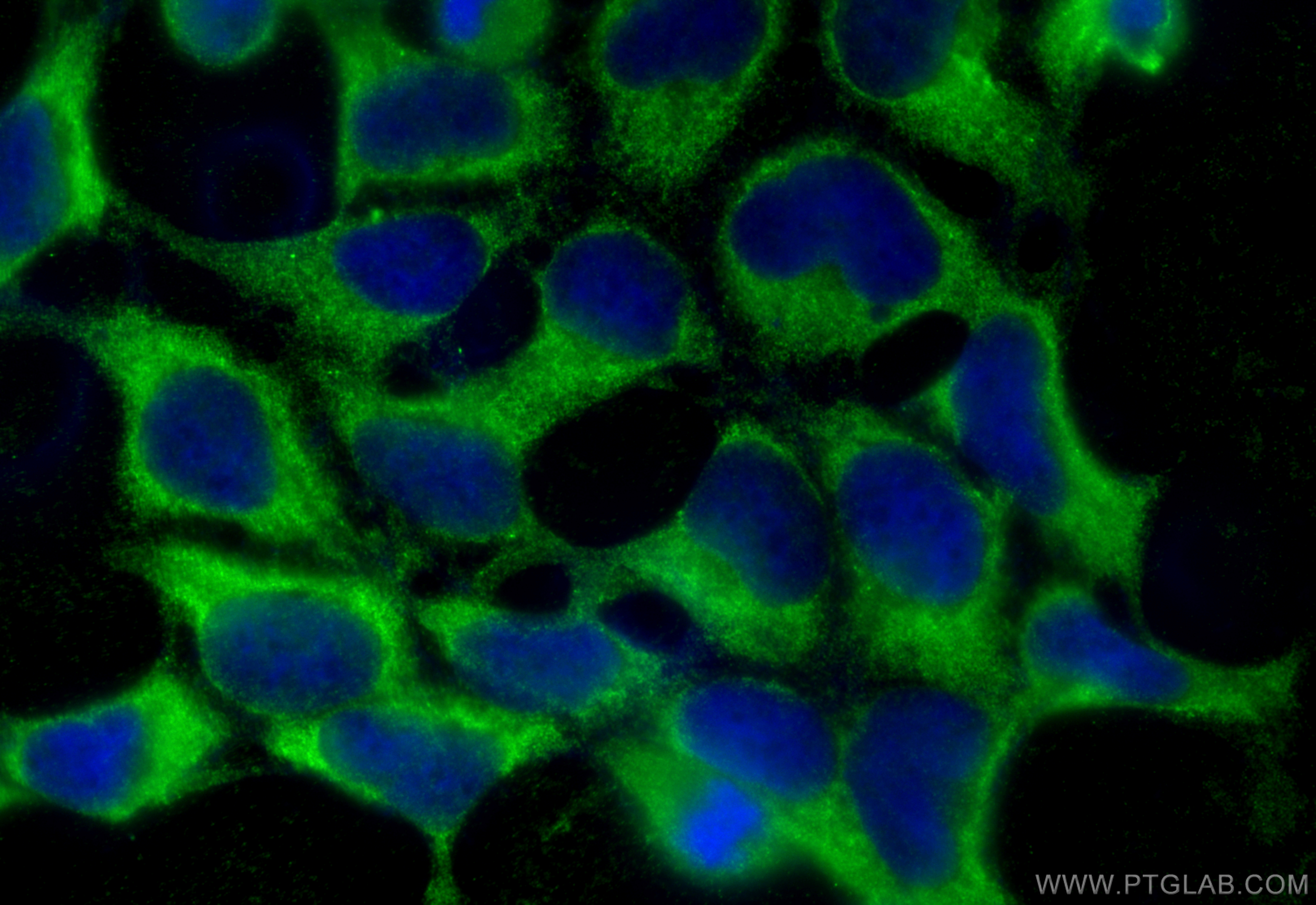 Immunofluorescence (IF) / fluorescent staining of HEK-293 cells using PHD2/EGLN1 Monoclonal antibody (66589-1-Ig)