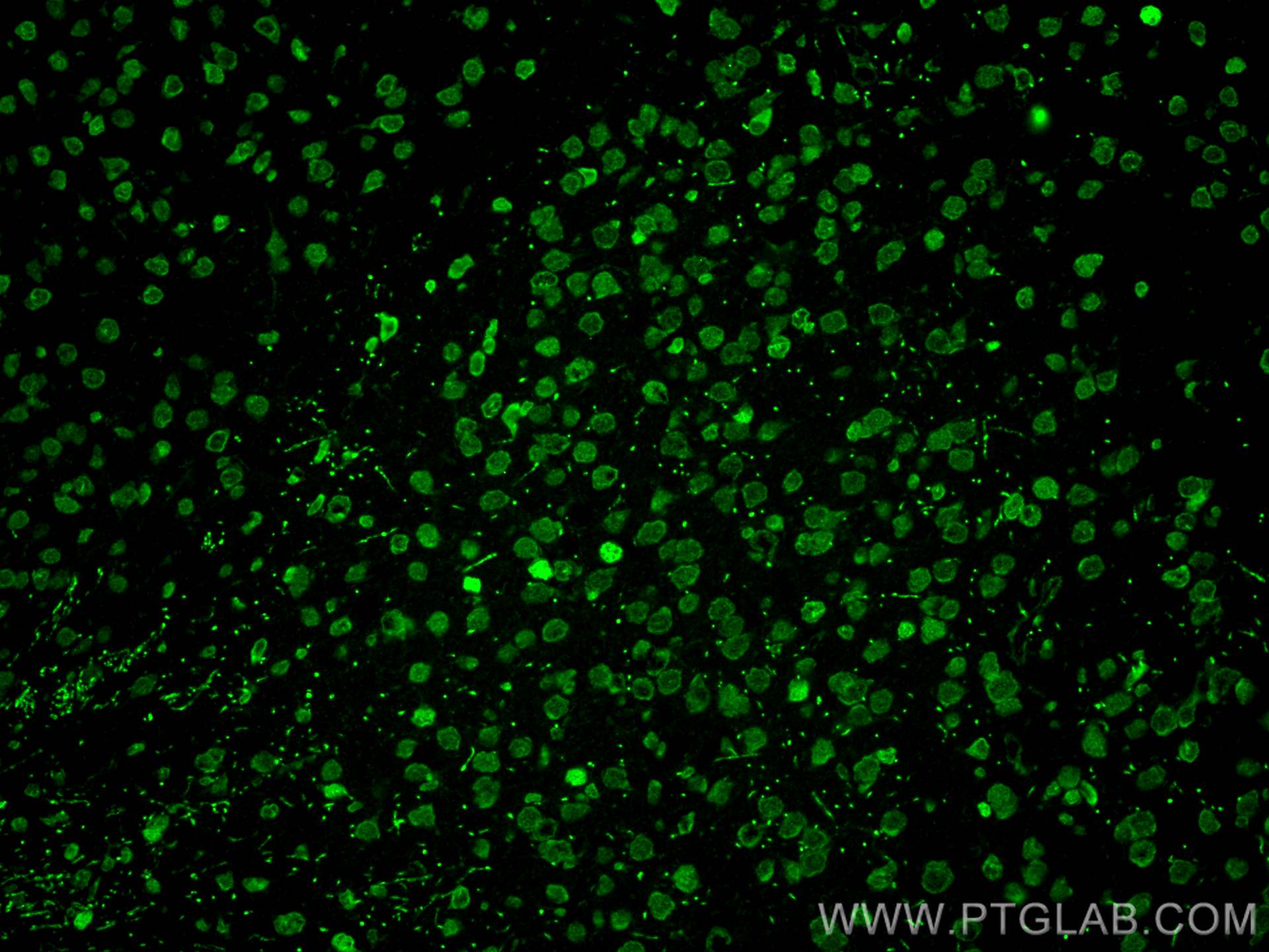 Immunofluorescence (IF) / fluorescent staining of mouse brain tissue using EGR1 Polyclonal antibody (22008-1-AP)