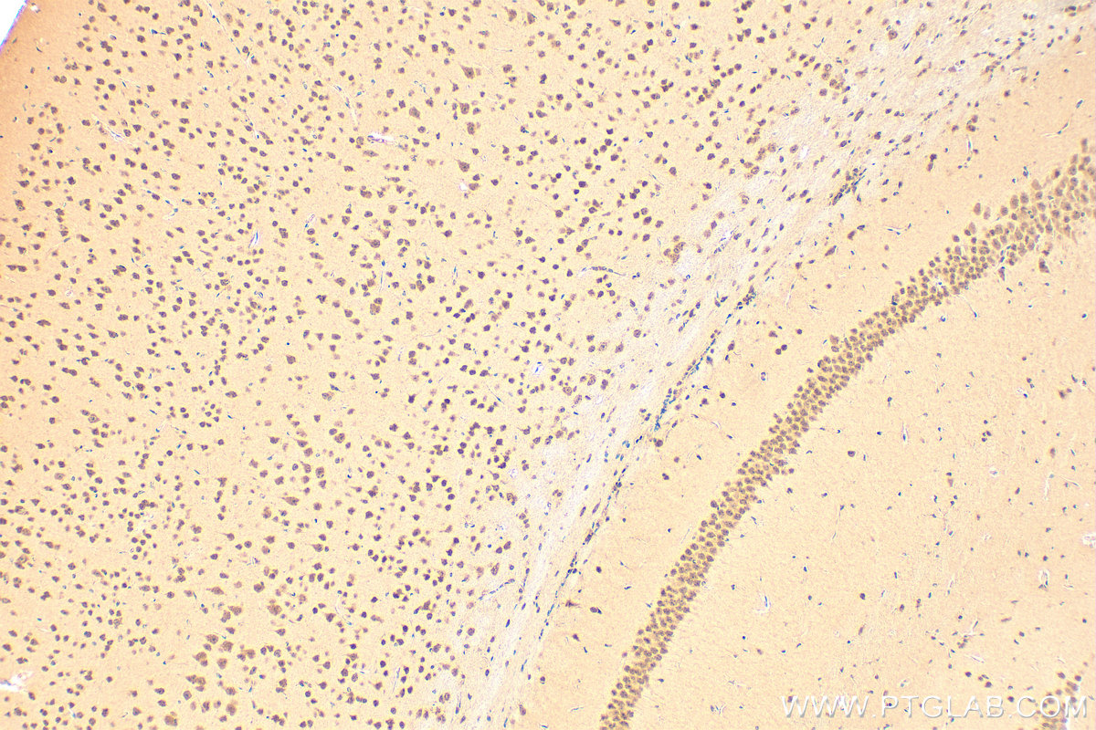 Immunohistochemistry (IHC) staining of mouse brain tissue using EGR2 Polyclonal antibody (13491-1-AP)