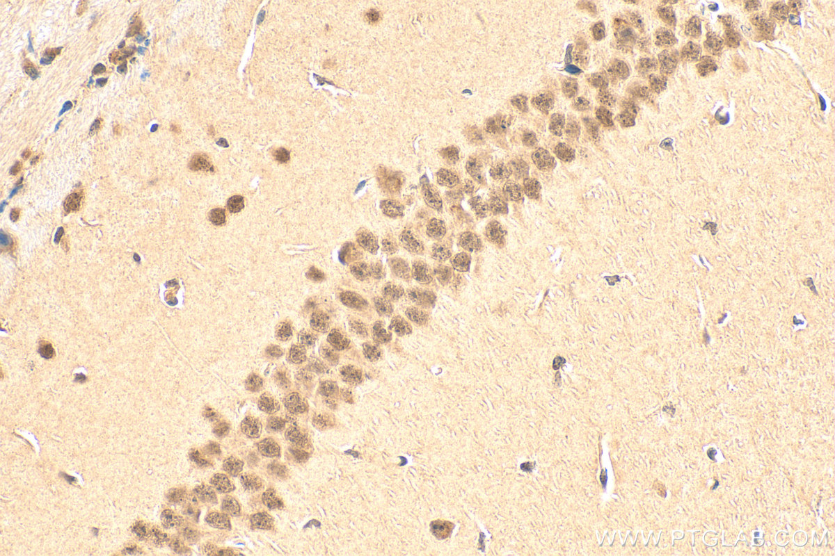 Immunohistochemistry (IHC) staining of mouse brain tissue using EGR2 Polyclonal antibody (13491-1-AP)