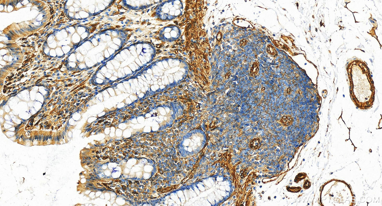 Immunohistochemistry (IHC) staining of human colon tissue using EHD2 Polyclonal antibody (11440-1-AP)