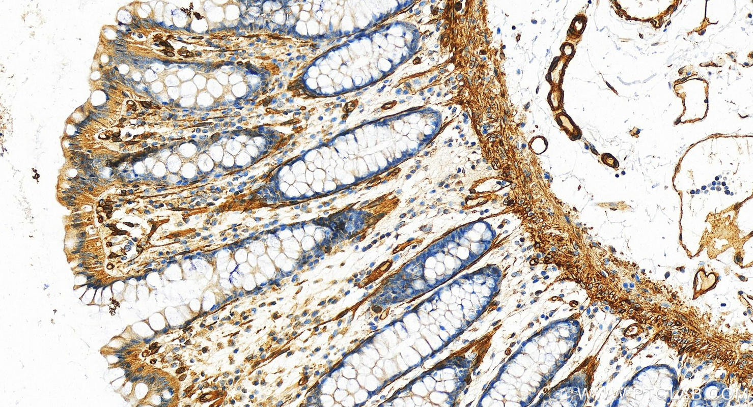 Immunohistochemistry (IHC) staining of human colon tissue using EHD2 Polyclonal antibody (11440-1-AP)