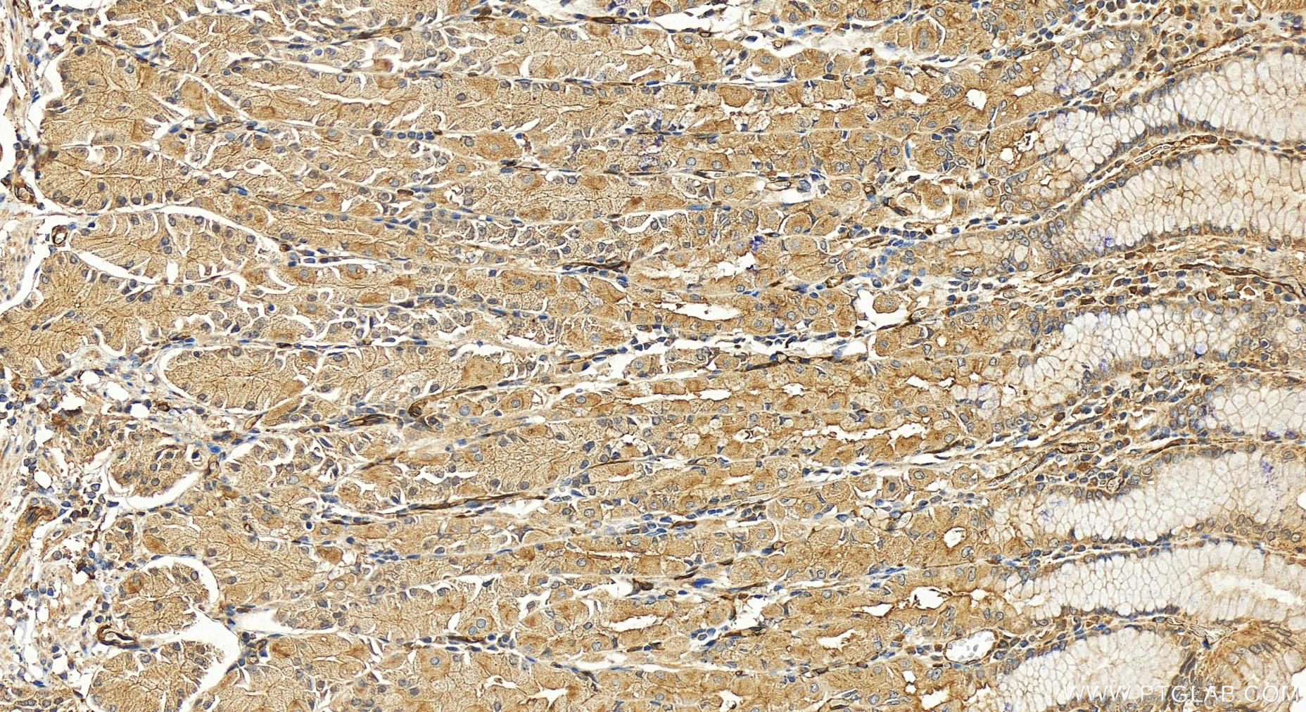 Immunohistochemistry (IHC) staining of human stomach tissue using EHD4 Polyclonal antibody (11382-2-AP)