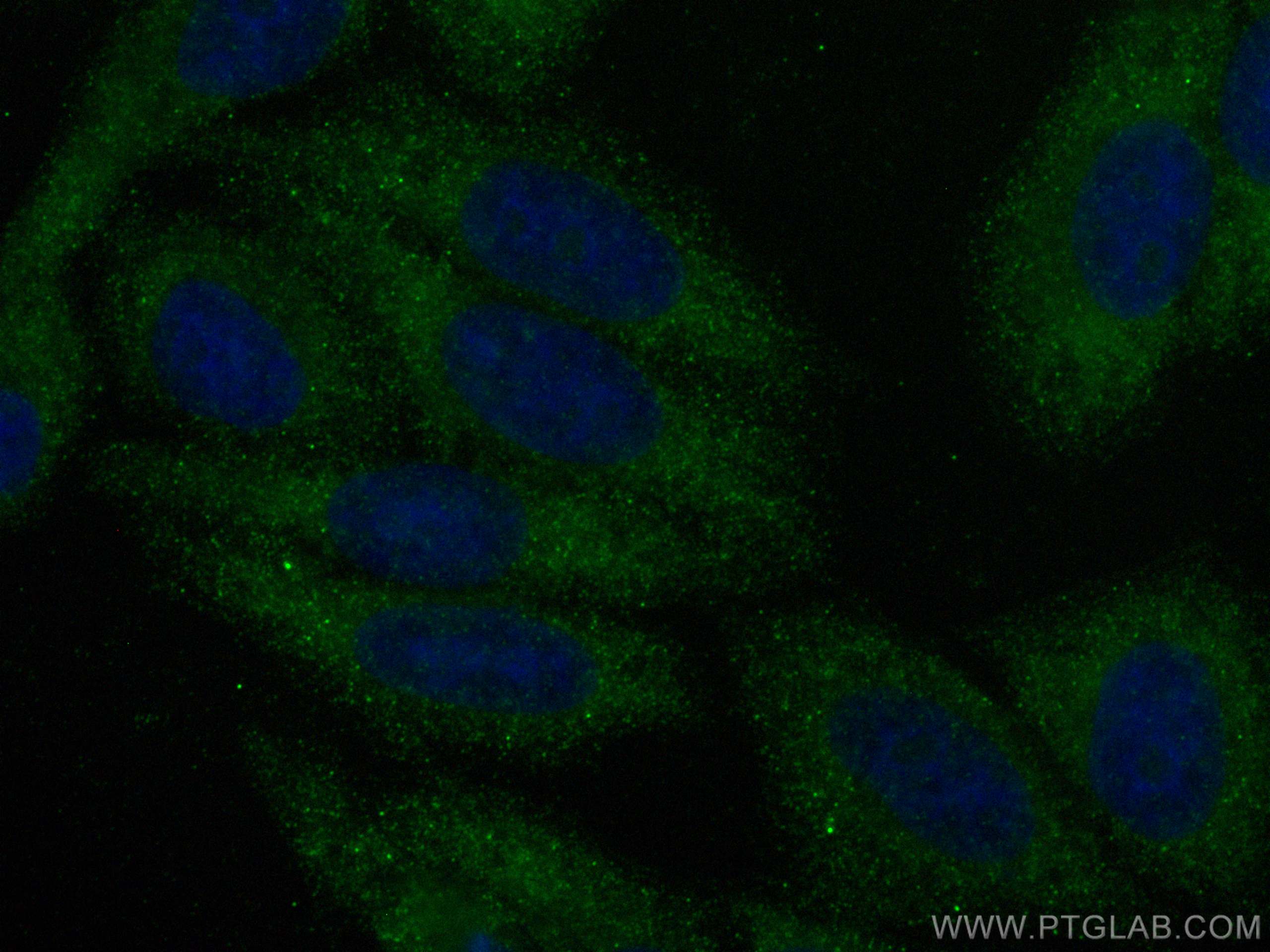 Immunofluorescence (IF) / fluorescent staining of HepG2 cells using EIF1AX Polyclonal antibody (14654-1-AP)