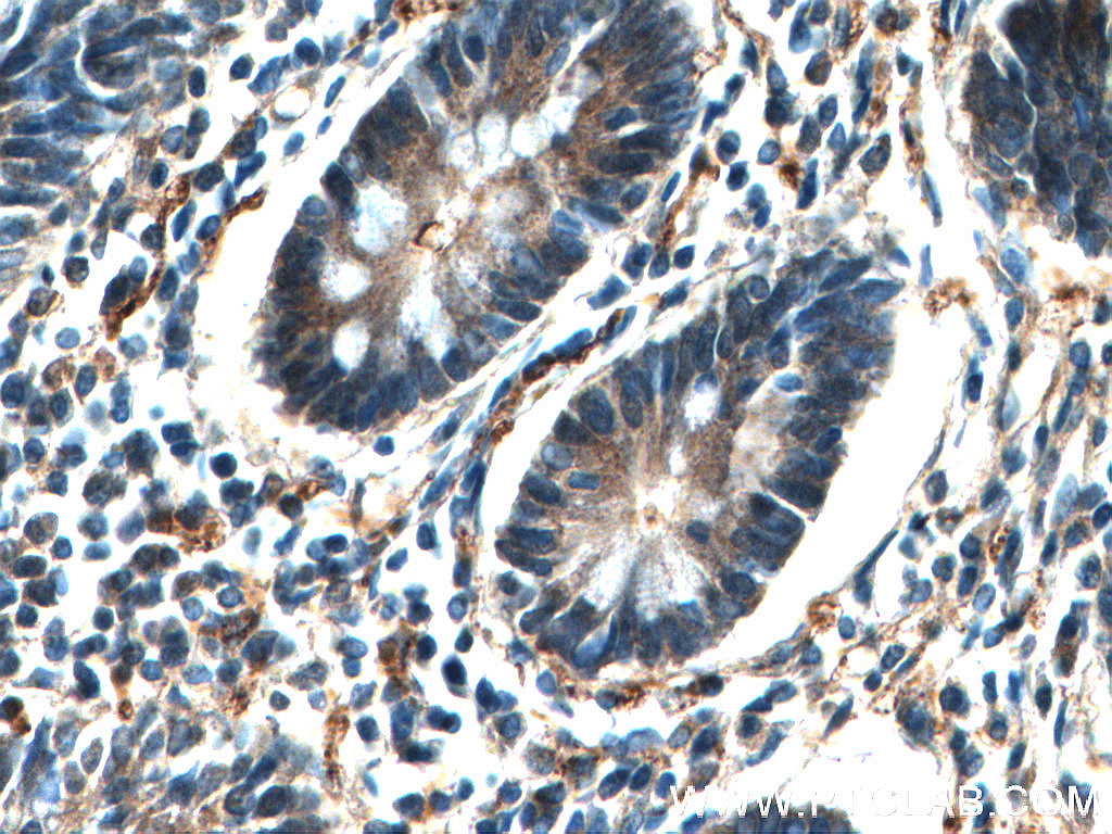 Immunohistochemistry (IHC) staining of human small intestine tissue using EIF2AK4 Polyclonal antibody (27944-1-AP)