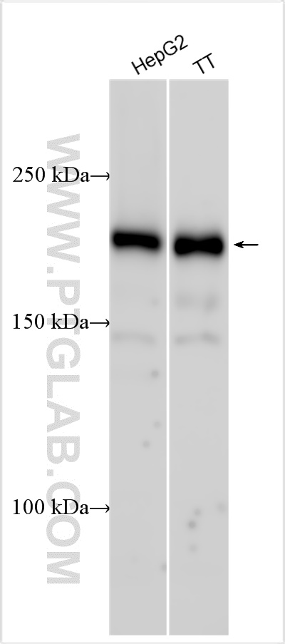 Western Blot (WB) analysis of various lysates using EIF2AK4 Polyclonal antibody (27944-1-AP)