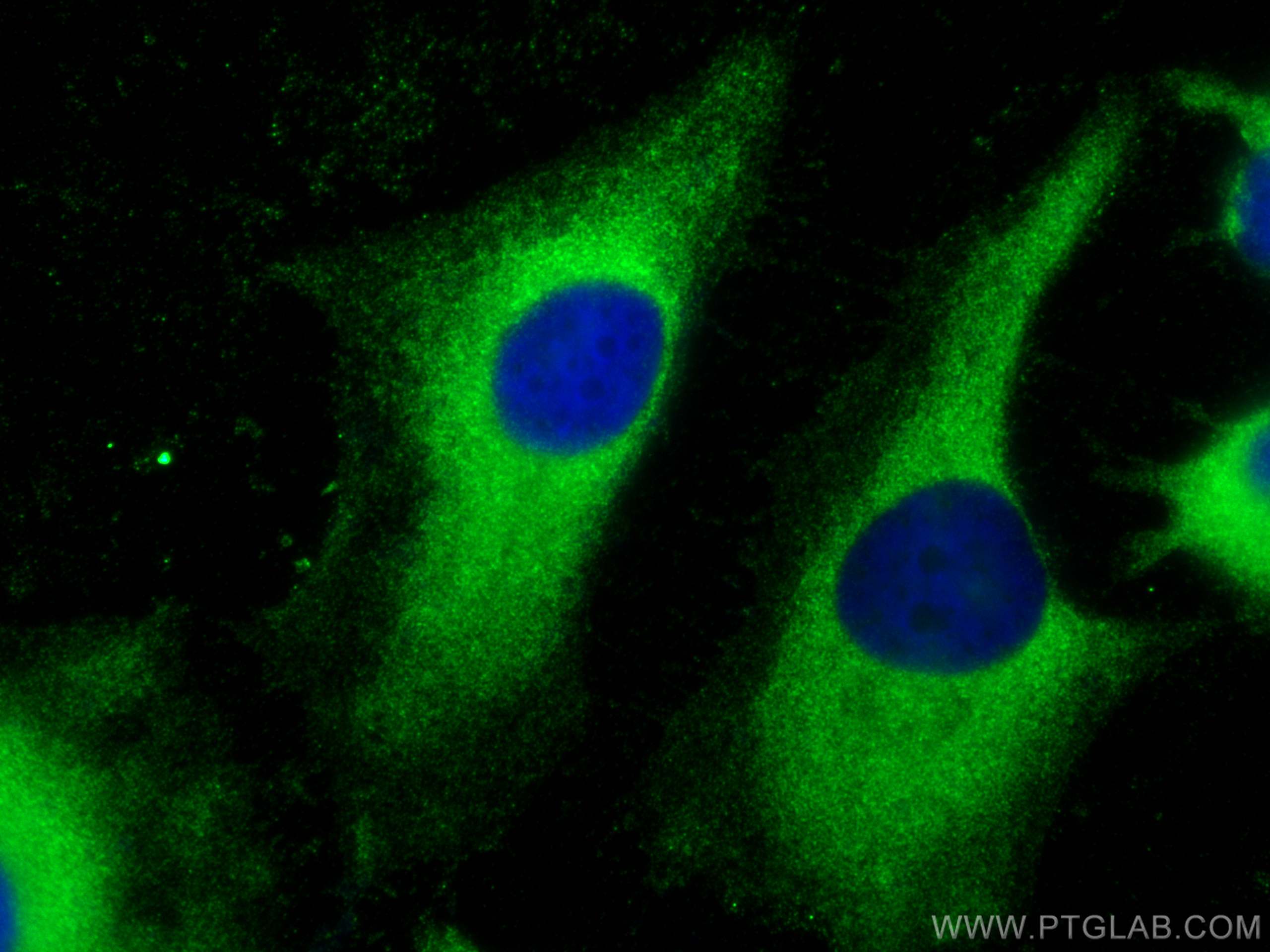 Immunofluorescence (IF) / fluorescent staining of HeLa cells using EIF2B1 Polyclonal antibody (18010-1-AP)