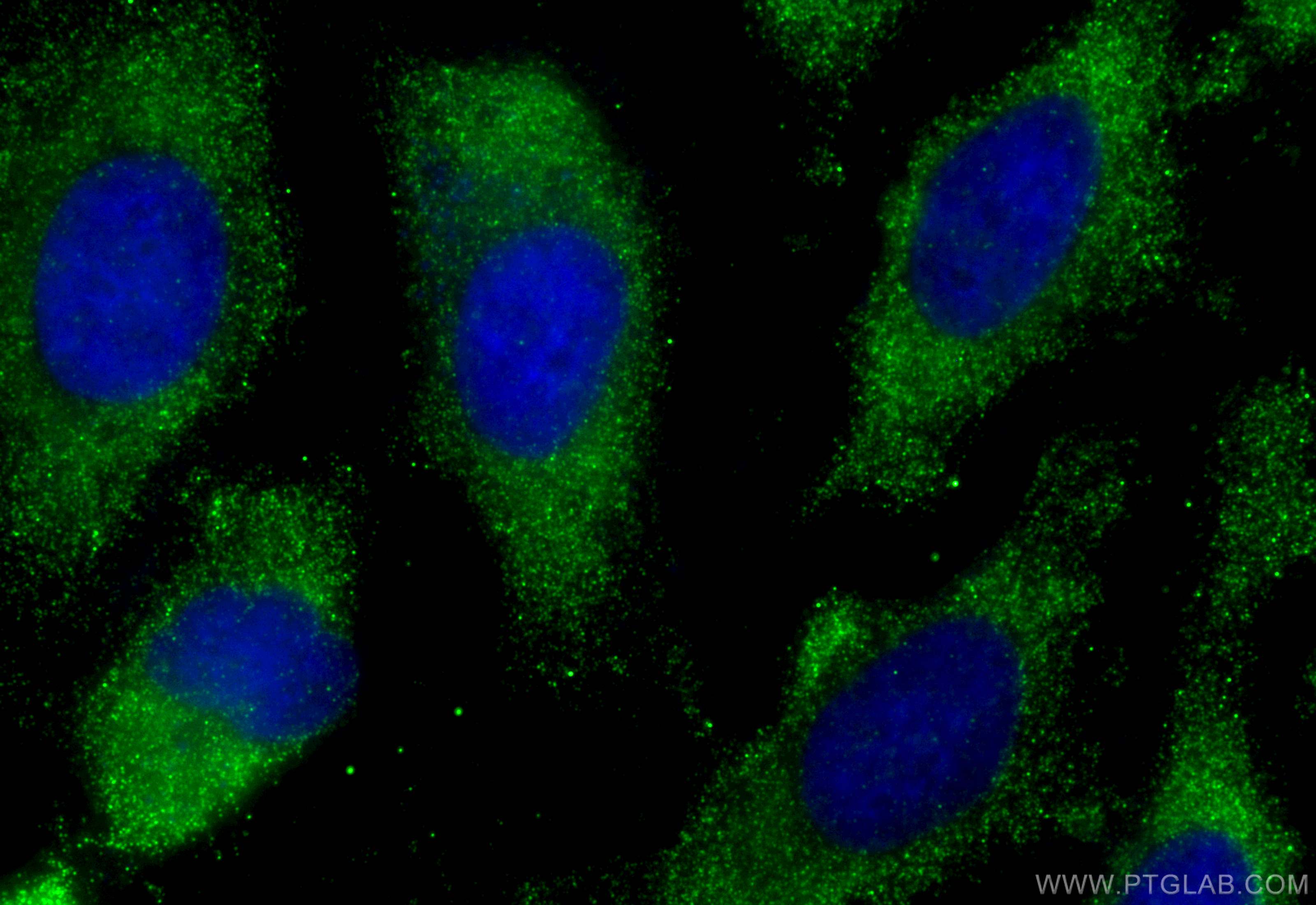 Immunofluorescence (IF) / fluorescent staining of HeLa cells using EIF2B1 Monoclonal antibody (68824-1-Ig)