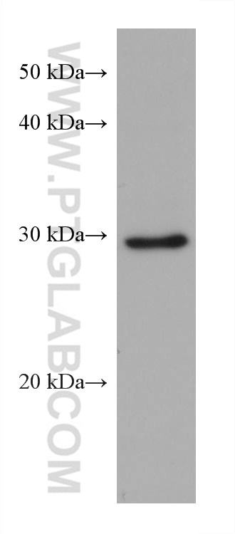 Western Blot (WB) analysis of NIH/3T3 cells using EIF2B1 Monoclonal antibody (68824-1-Ig)