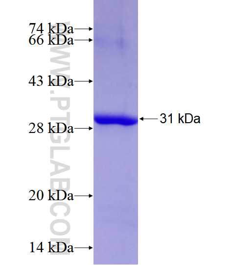 EIF2B3 fusion protein Ag28525 SDS-PAGE