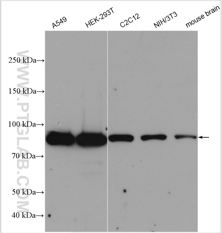 EIF2B5