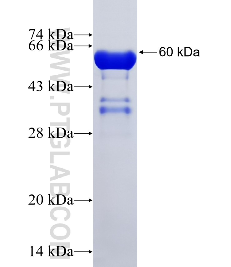 EIF2B5 fusion protein Ag32175 SDS-PAGE