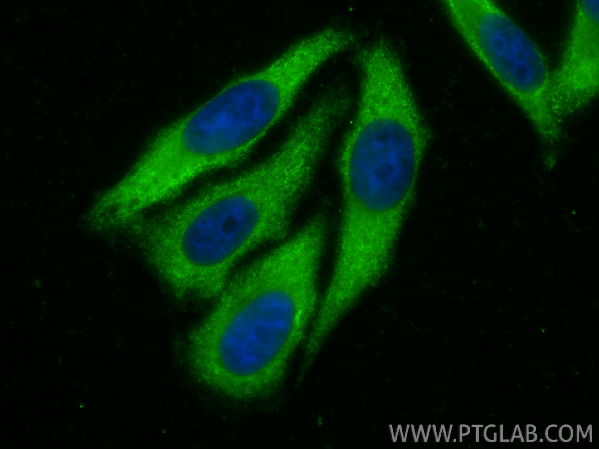 Immunofluorescence (IF) / fluorescent staining of HepG2 cells using EIF2S1 Polyclonal antibody (11170-1-AP)