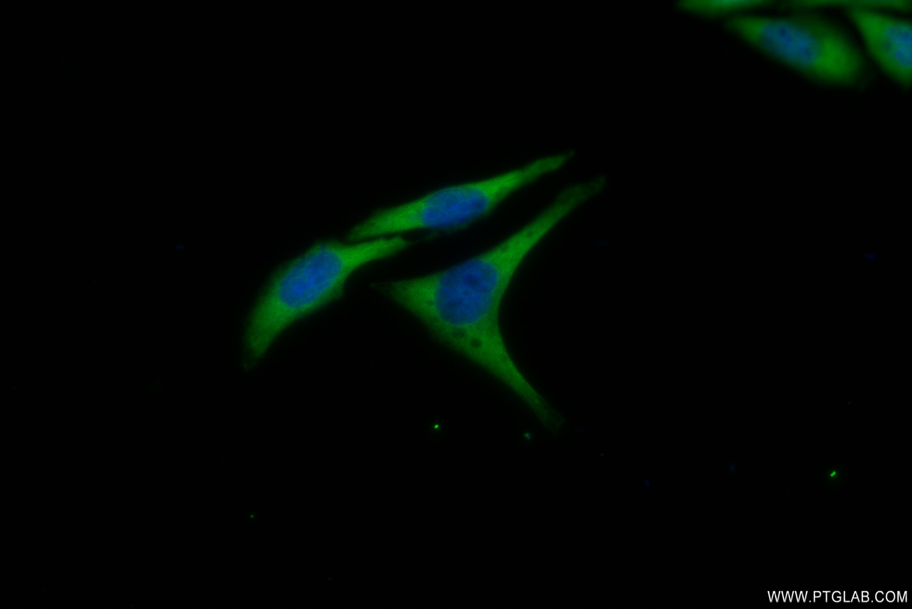 Immunofluorescence (IF) / fluorescent staining of HepG2 cells using EIF2S1 Recombinant antibody (82936-1-RR)