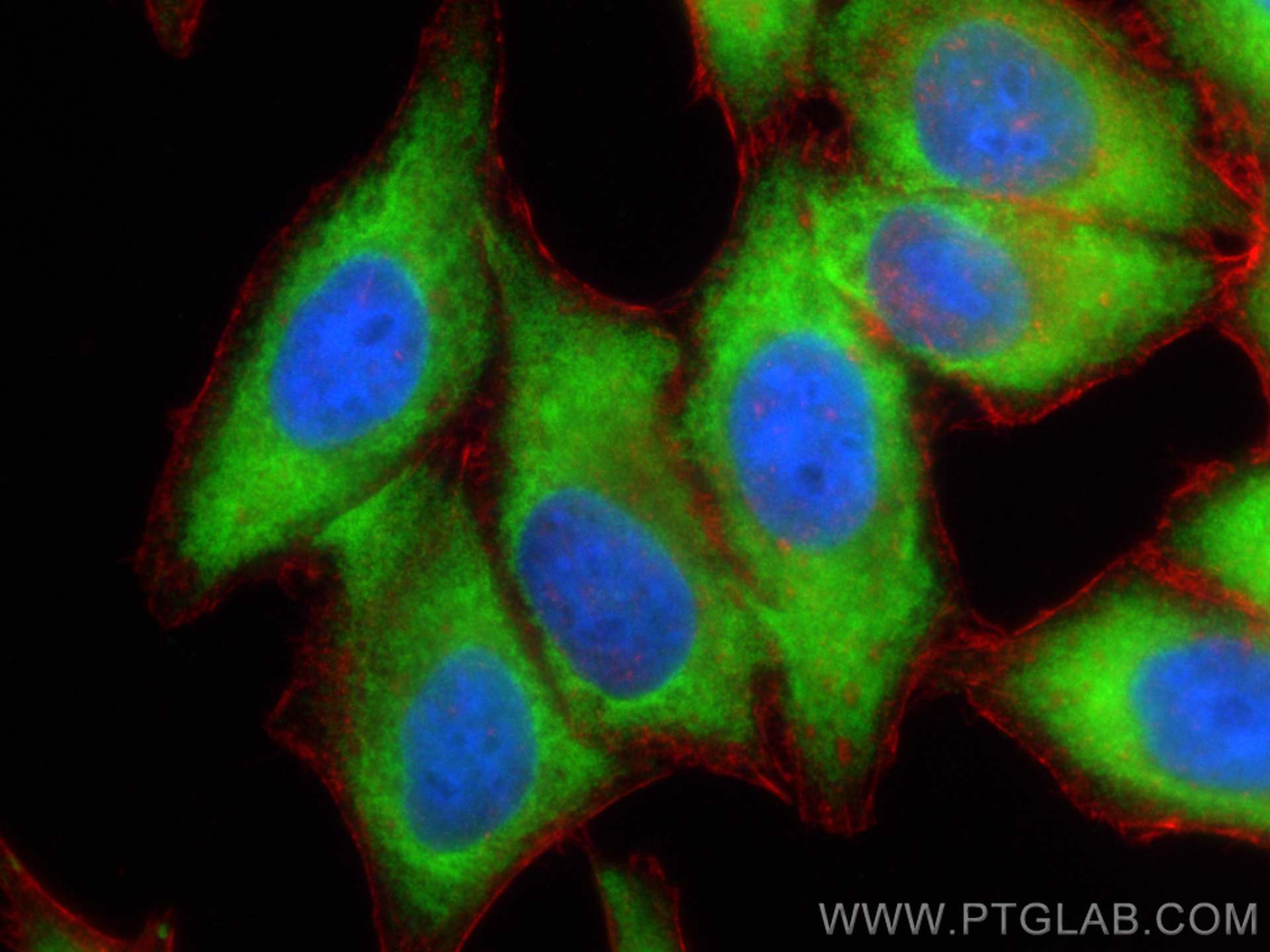 Immunofluorescence (IF) / fluorescent staining of HepG2 cells using EIF2S1 Recombinant antibody (82936-1-RR)