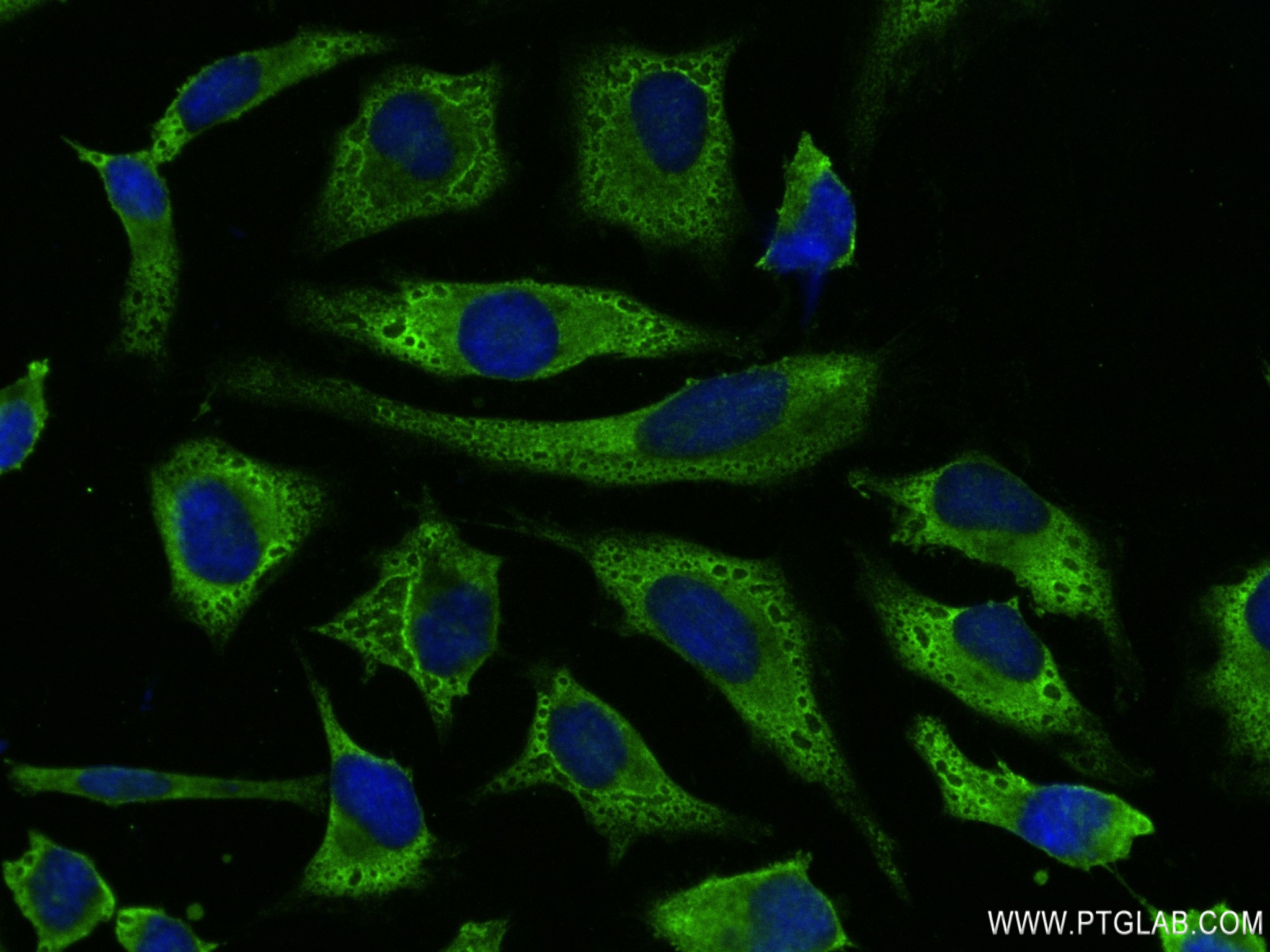 Immunofluorescence (IF) / fluorescent staining of HeLa cells using EIF2S1 Recombinant antibody (82936-8-RR)