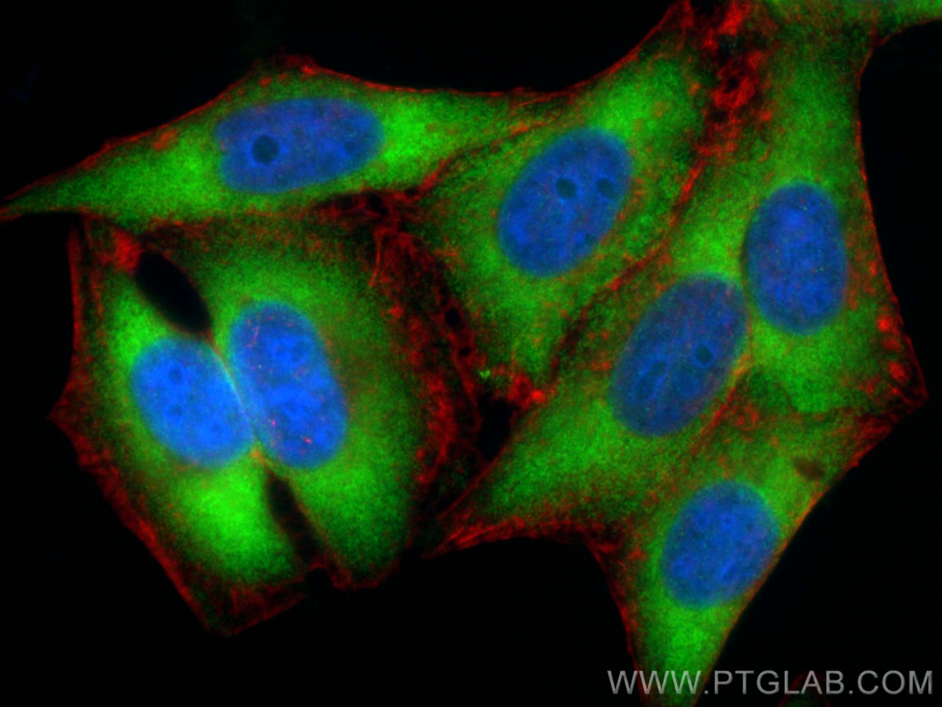 Immunofluorescence (IF) / fluorescent staining of HepG2 cells using EIF2S1 Recombinant antibody (82936-8-RR)