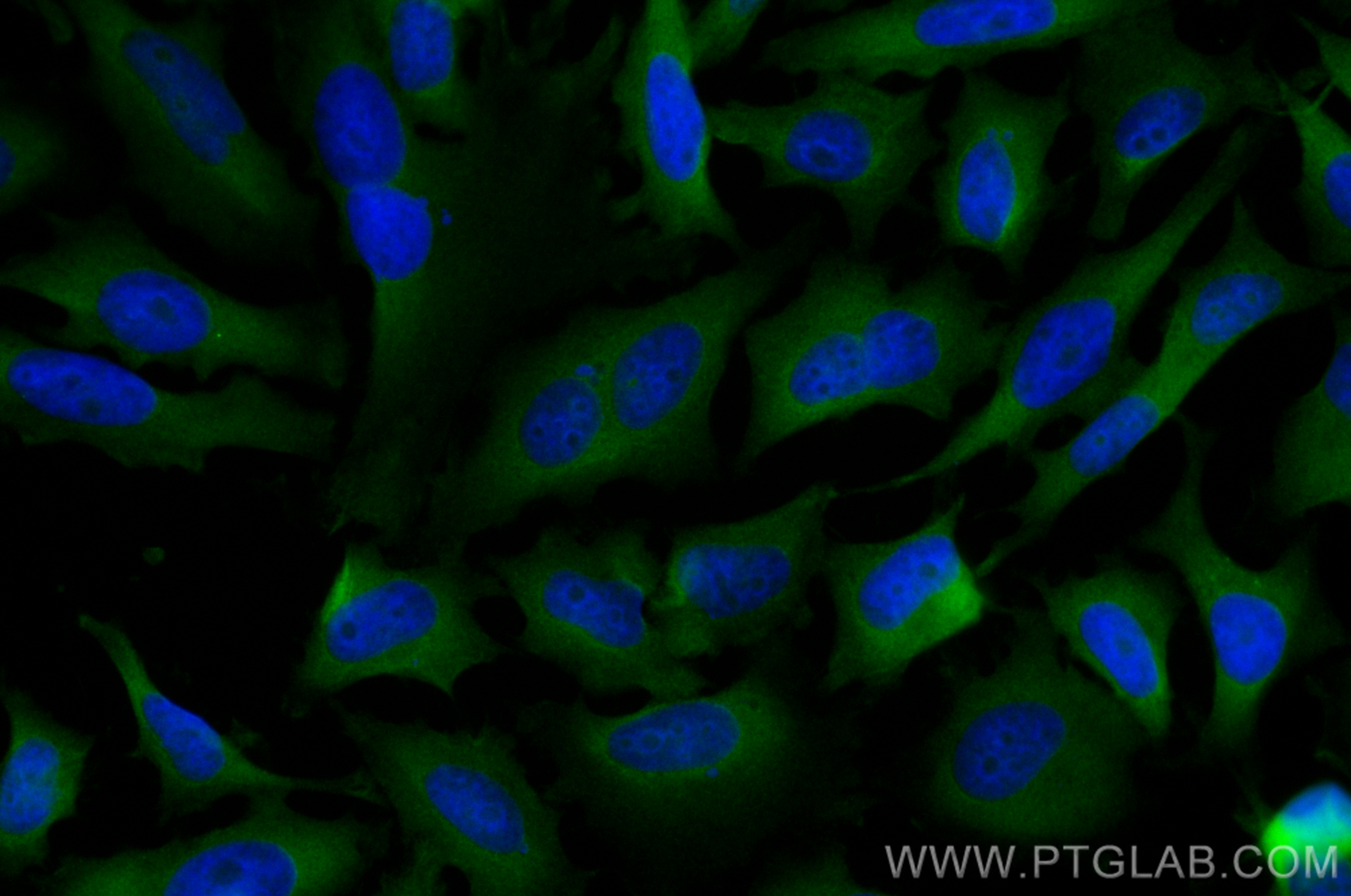 Immunofluorescence (IF) / fluorescent staining of HeLa cells using CoraLite® Plus 488-conjugated EIF2S1 Recombinant a (CL488-82936-8)
