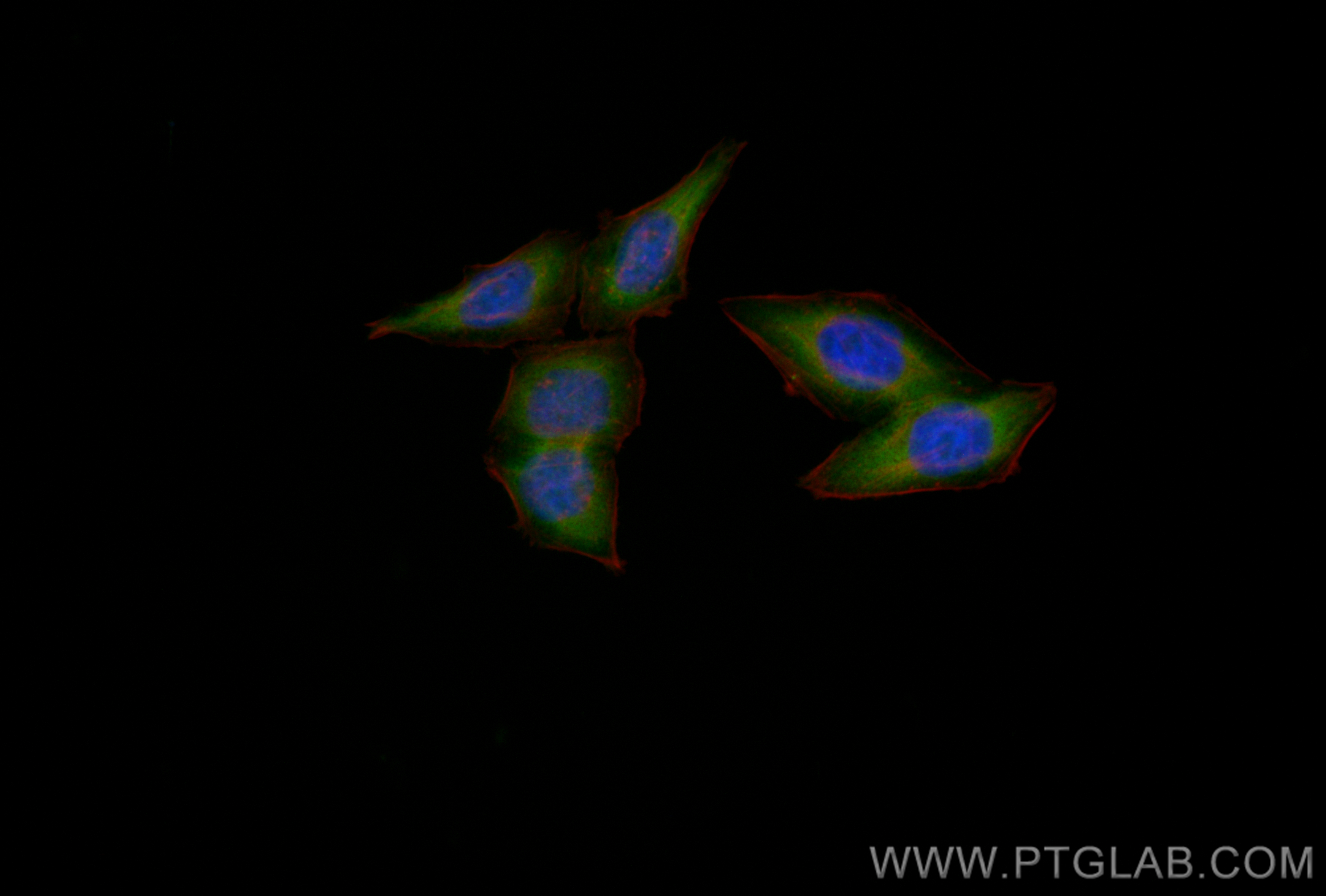 Immunofluorescence (IF) / fluorescent staining of HepG2 cells using CoraLite® Plus 488-conjugated EIF2S1 Recombinant a (CL488-82936)
