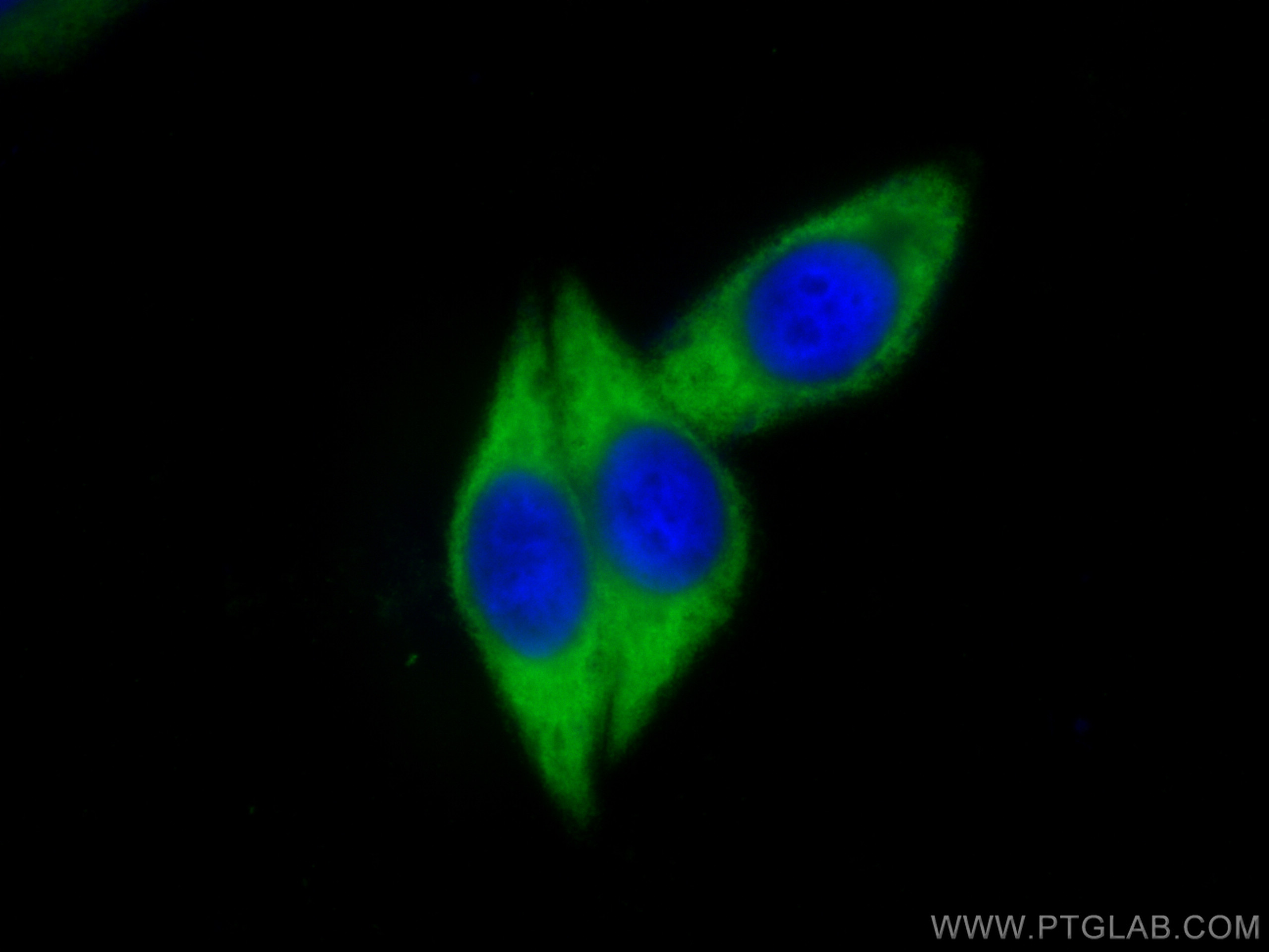 Immunofluorescence (IF) / fluorescent staining of HepG2 cells using EIF2S2 Polyclonal antibody (10227-1-AP)