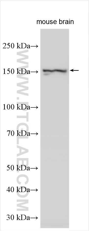 Western Blot (WB) analysis of various lysates using EIF3A Polyclonal antibody (26178-1-AP)