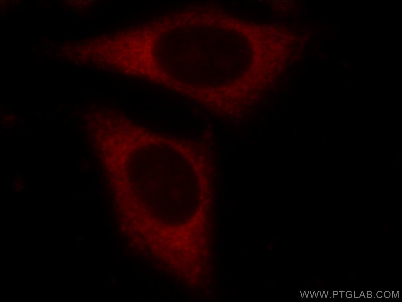 Immunofluorescence (IF) / fluorescent staining of HepG2 cells using EIF3D Polyclonal antibody (10219-1-AP)