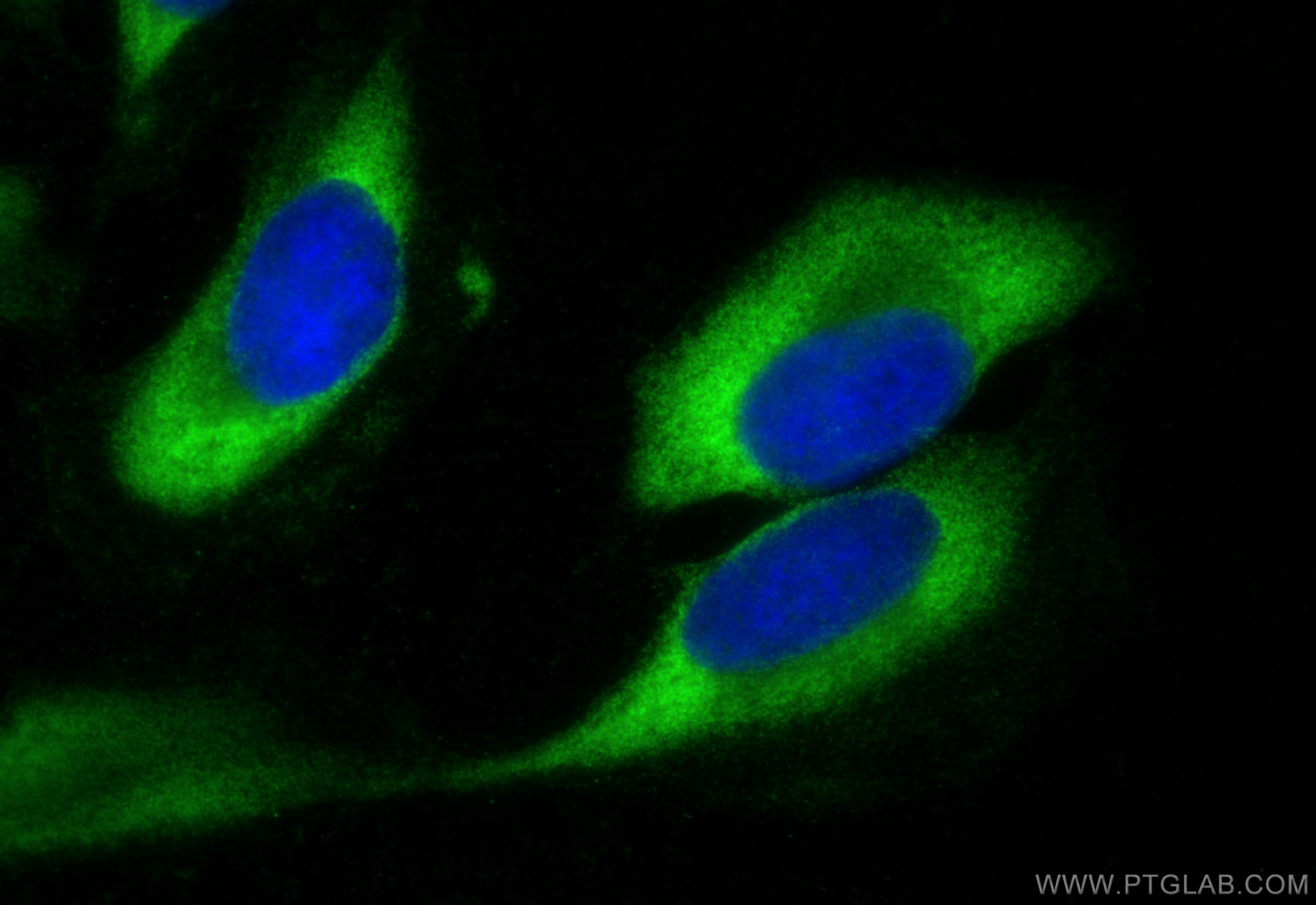 Immunofluorescence (IF) / fluorescent staining of U2OS cells using EIF3D Recombinant antibody (82512-1-RR)