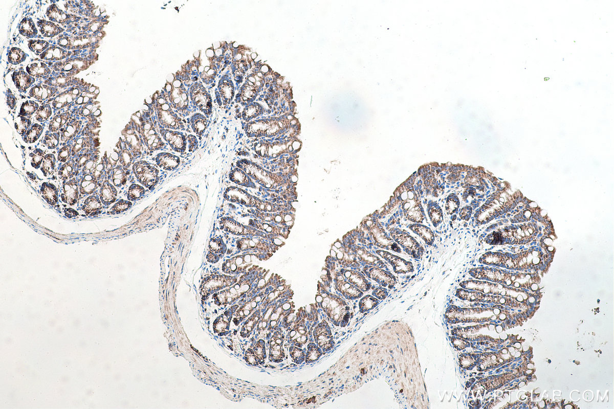 Immunohistochemistry (IHC) staining of mouse colon tissue using EIF3G Polyclonal antibody (11165-1-AP)