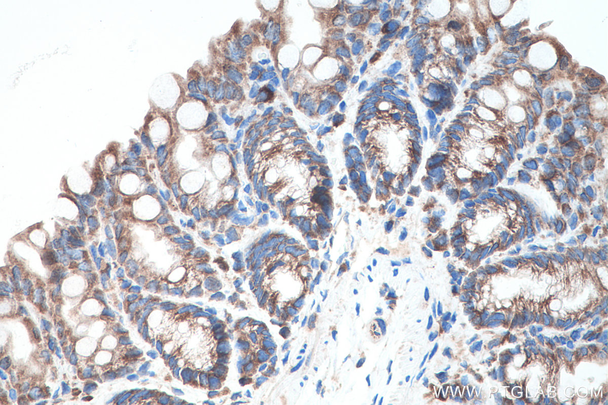 Immunohistochemistry (IHC) staining of mouse colon tissue using EIF3G Polyclonal antibody (11165-1-AP)