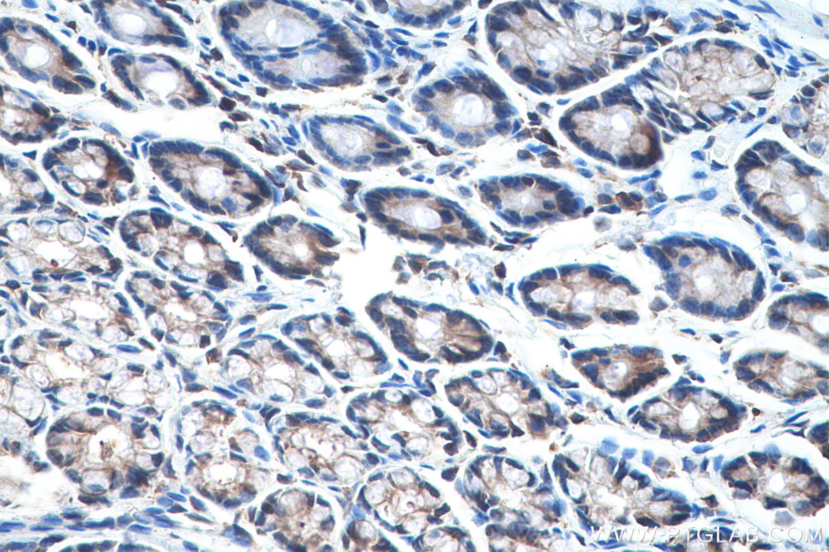 Immunohistochemistry (IHC) staining of rat colon tissue using EIF3G Polyclonal antibody (11165-1-AP)