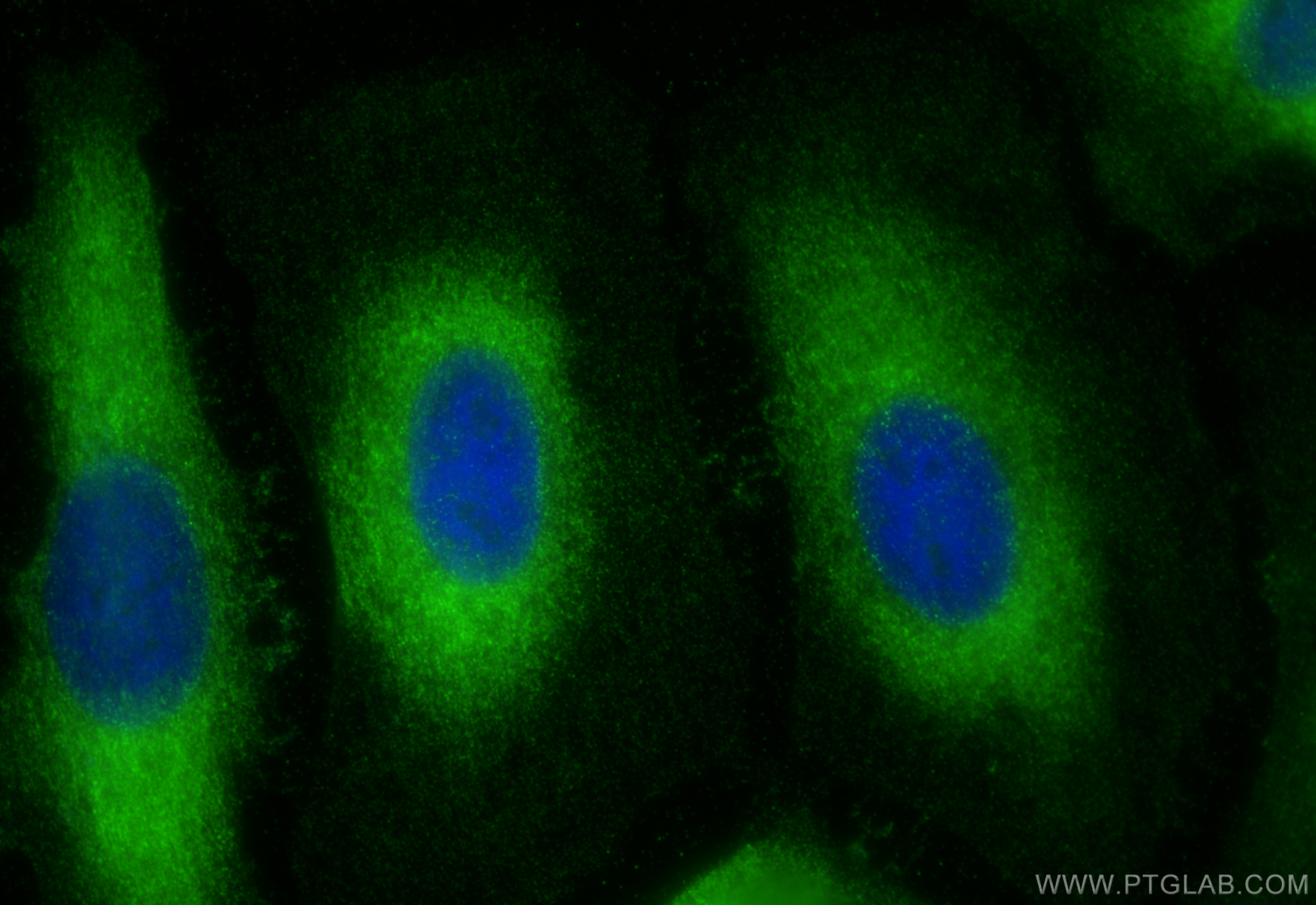 Immunofluorescence (IF) / fluorescent staining of HeLa cells using EIF3I Polyclonal antibody (11287-1-AP)