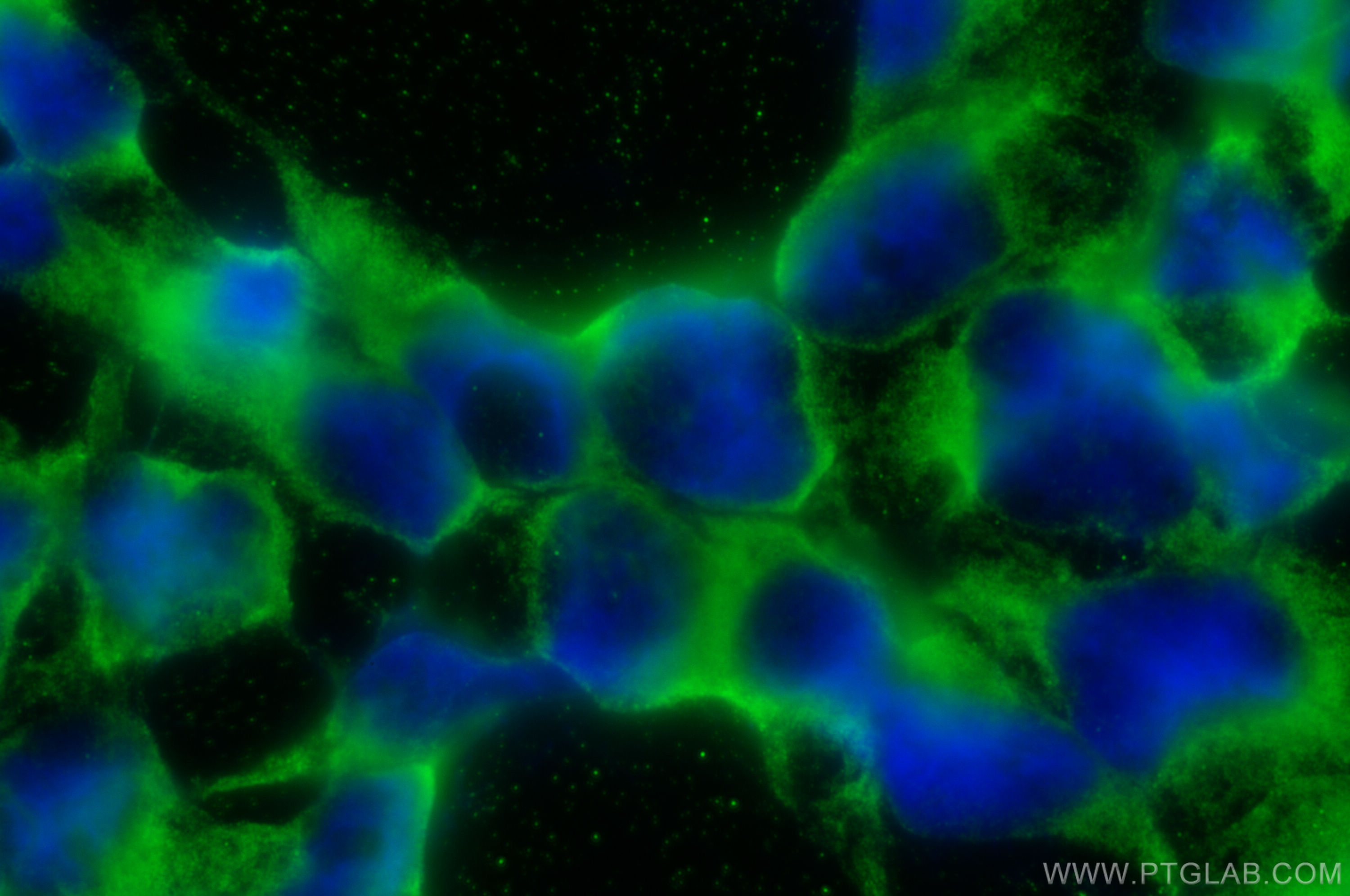 Immunofluorescence (IF) / fluorescent staining of HEK-293 cells using EIF4A2 Monoclonal antibody (67799-1-Ig)