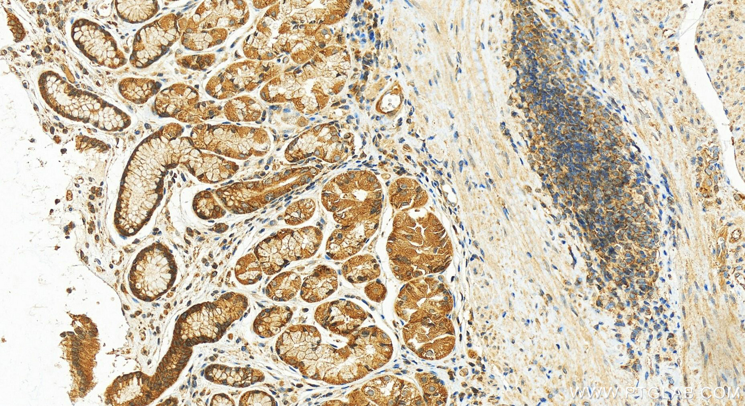 Immunohistochemistry (IHC) staining of human stomach tissue using EIF4B Polyclonal antibody (17917-1-AP)