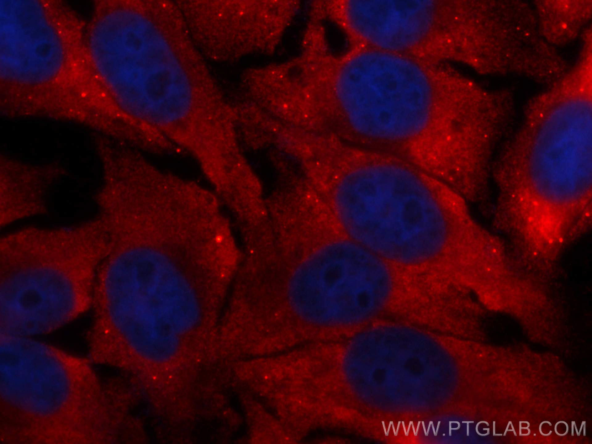 Immunofluorescence (IF) / fluorescent staining of HepG2 cells using CoraLite®594-conjugated EIF4E Monoclonal antibody (CL594-66655)