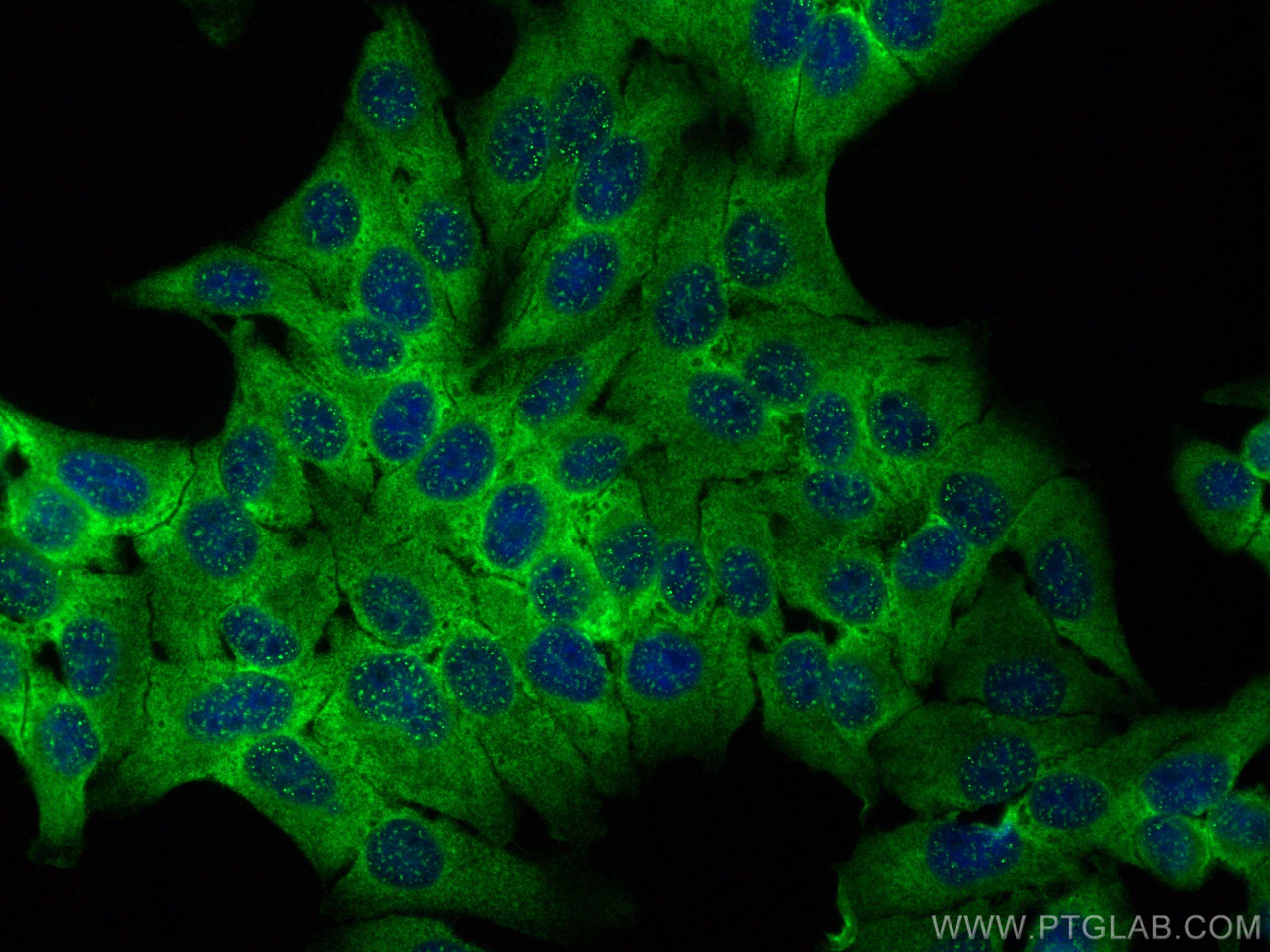 Immunofluorescence (IF) / fluorescent staining of HepG2 cells using EIF4G1 Polyclonal antibody (15704-1-AP)