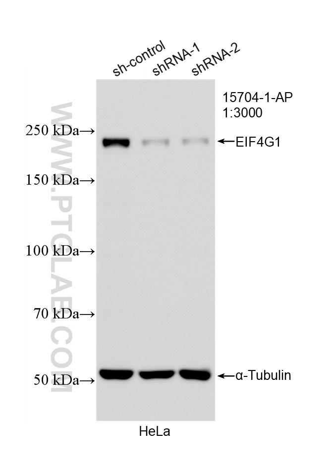 Western Blot (WB) analysis of HeLa cells using EIF4G1 Polyclonal antibody (15704-1-AP)