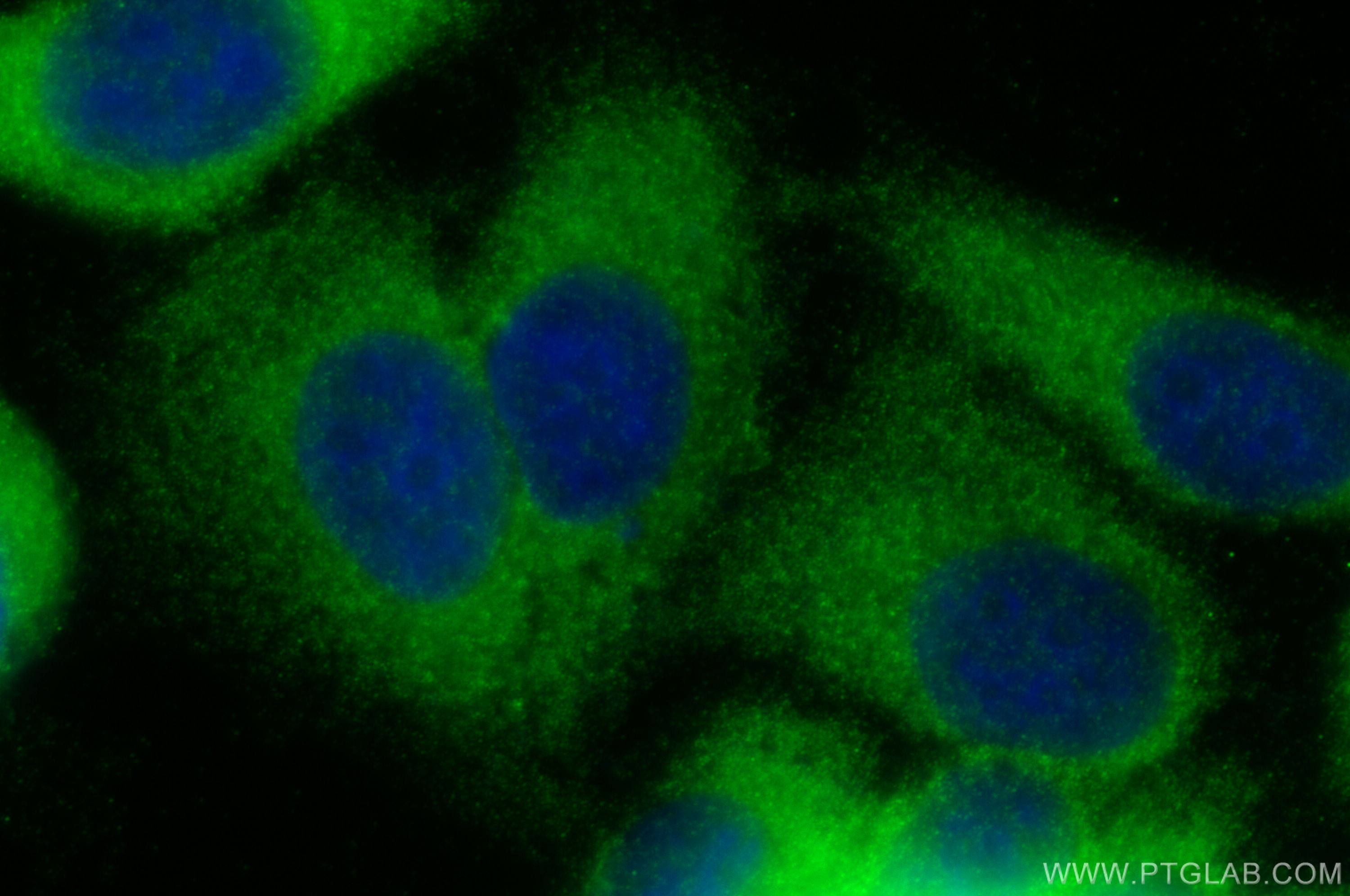 Immunofluorescence (IF) / fluorescent staining of HepG2 cells using eIF4G2/DAP5 Polyclonal antibody (17728-1-AP)