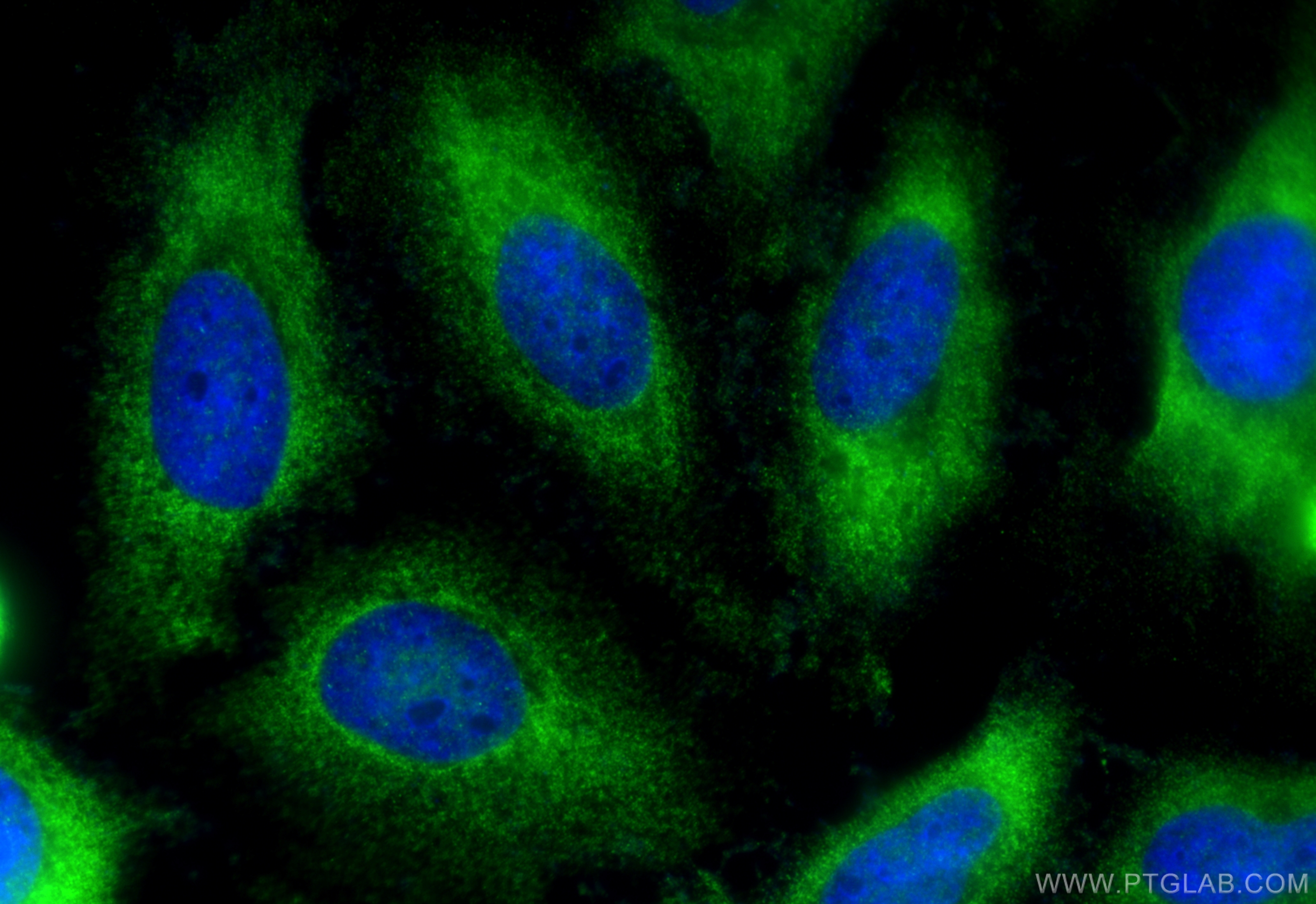 Immunofluorescence (IF) / fluorescent staining of HeLa cells using EIF4G3 Polyclonal antibody (11281-1-AP)